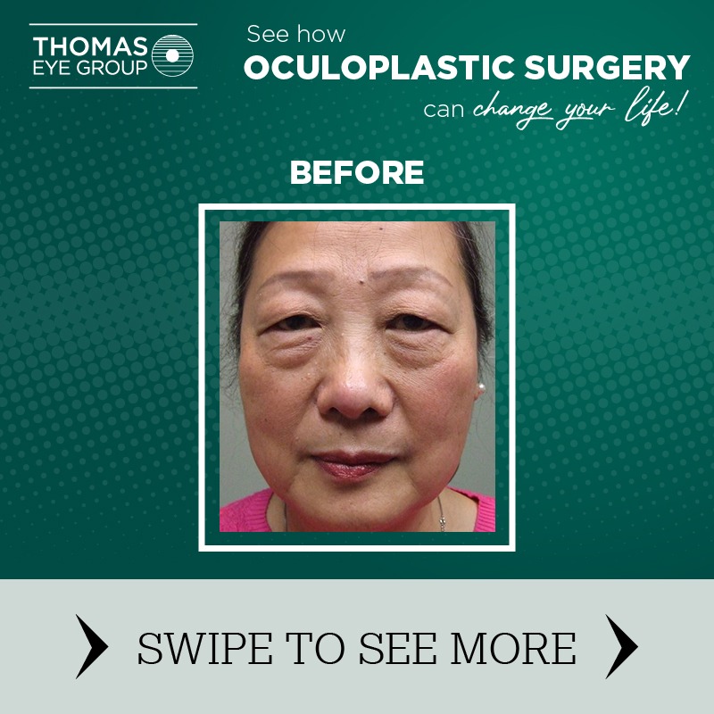 Thomas Eye Group Facebook ad: Meet with Dr Kenneth Neufeld to receive a…