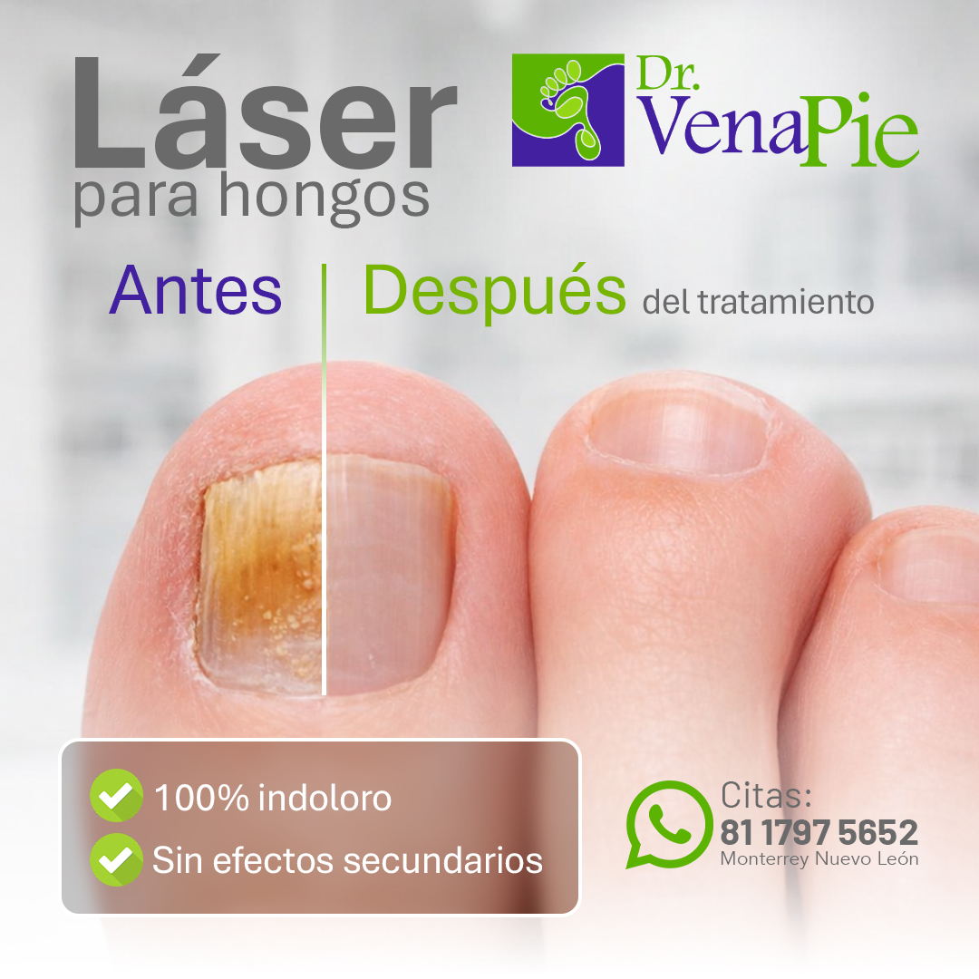 Dr. Vena Pie Facebook ad from Jul 8, 2026