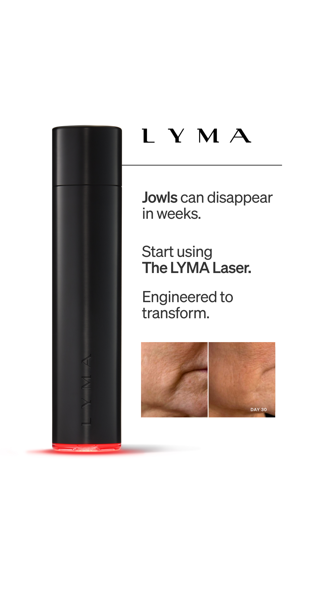 LYMA Facebook ad
