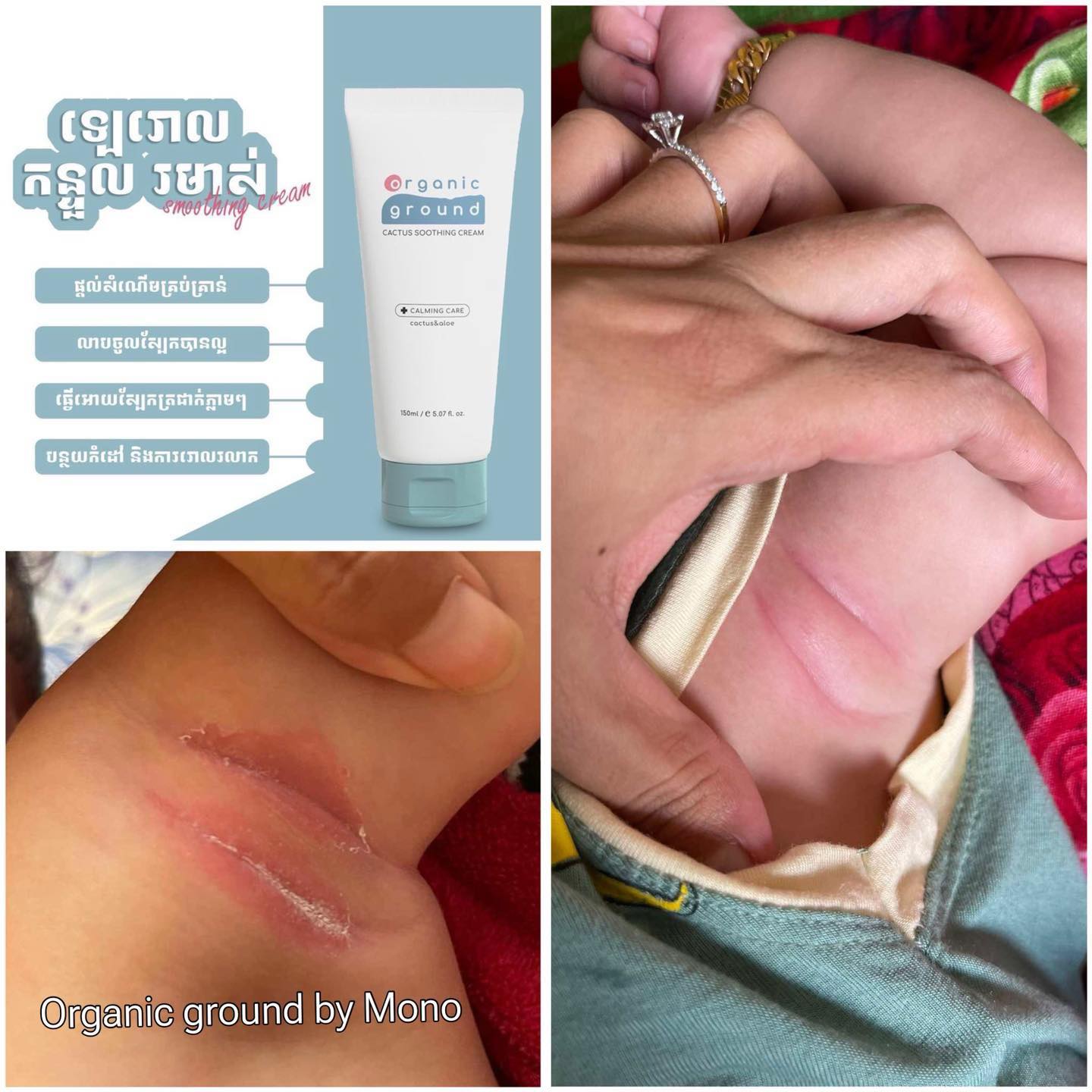 MONO Online Shop Facebook ad: ឡេរោល រលាក Cactus Soothing Cream របស់ប្រេន Organic Ground…