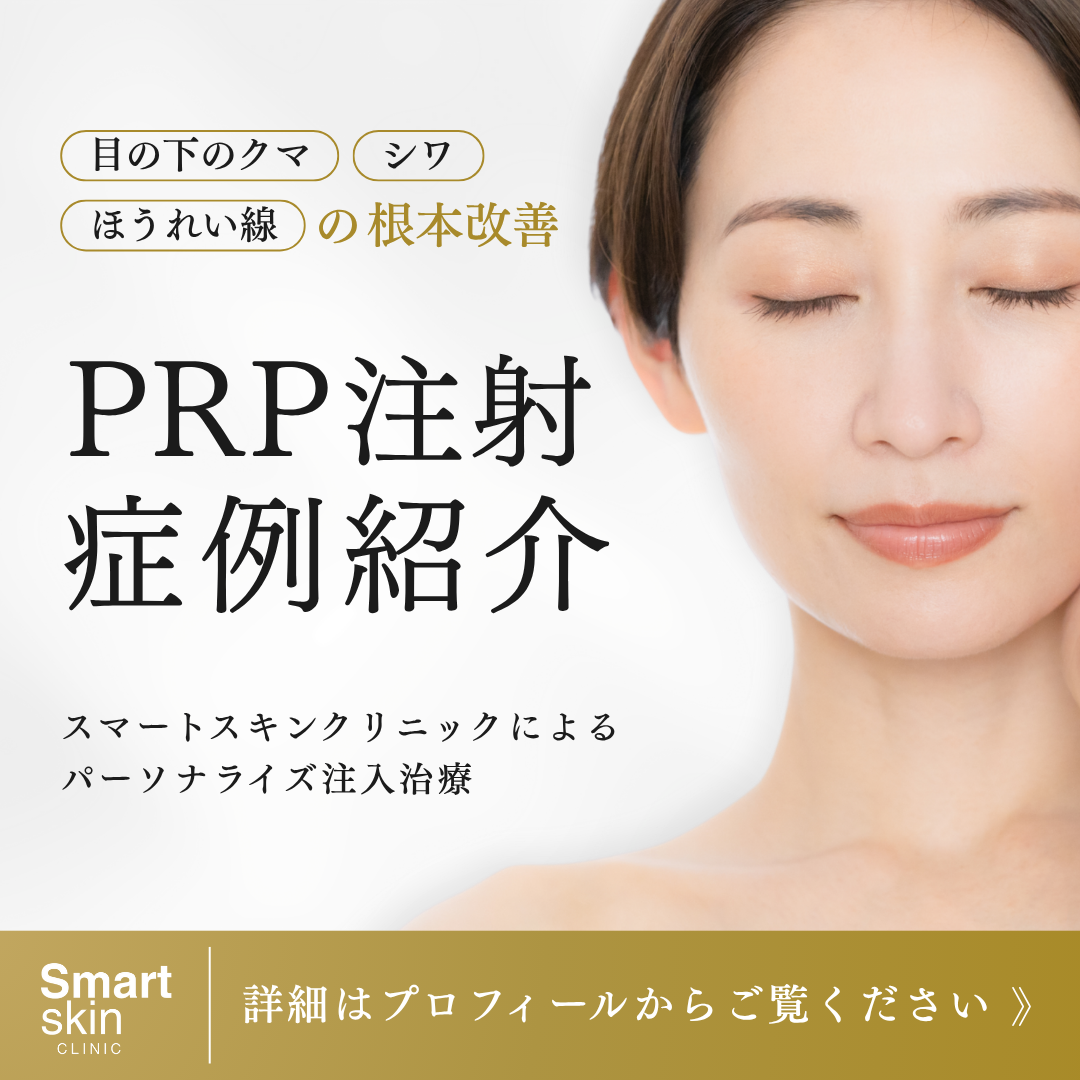 Smart skin Clinic for PRP Facebook ad
