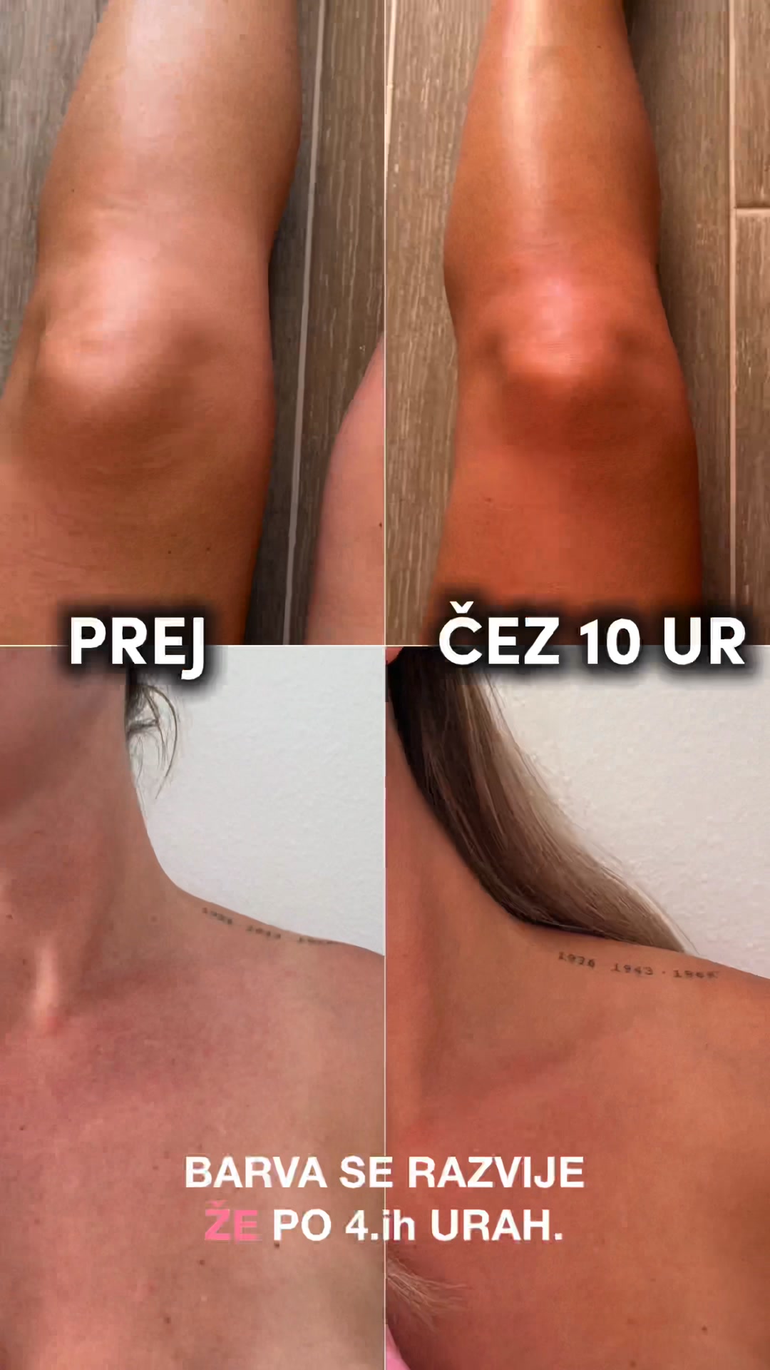 Clariteca Facebook ad: Porjavela koža brez posledic