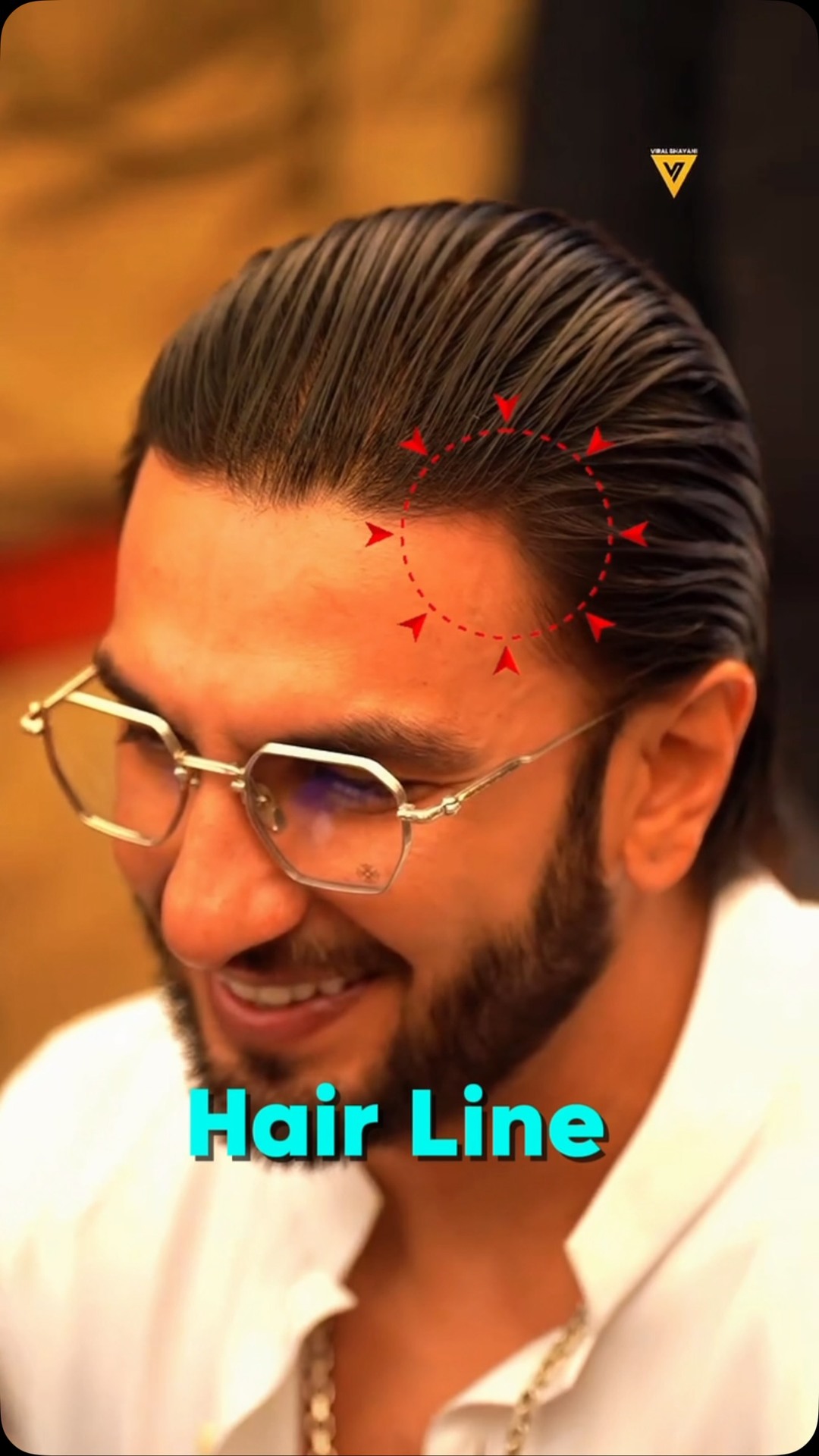 sethu.sush Facebook ad: Hairline dekho Ranveer Singh ki!