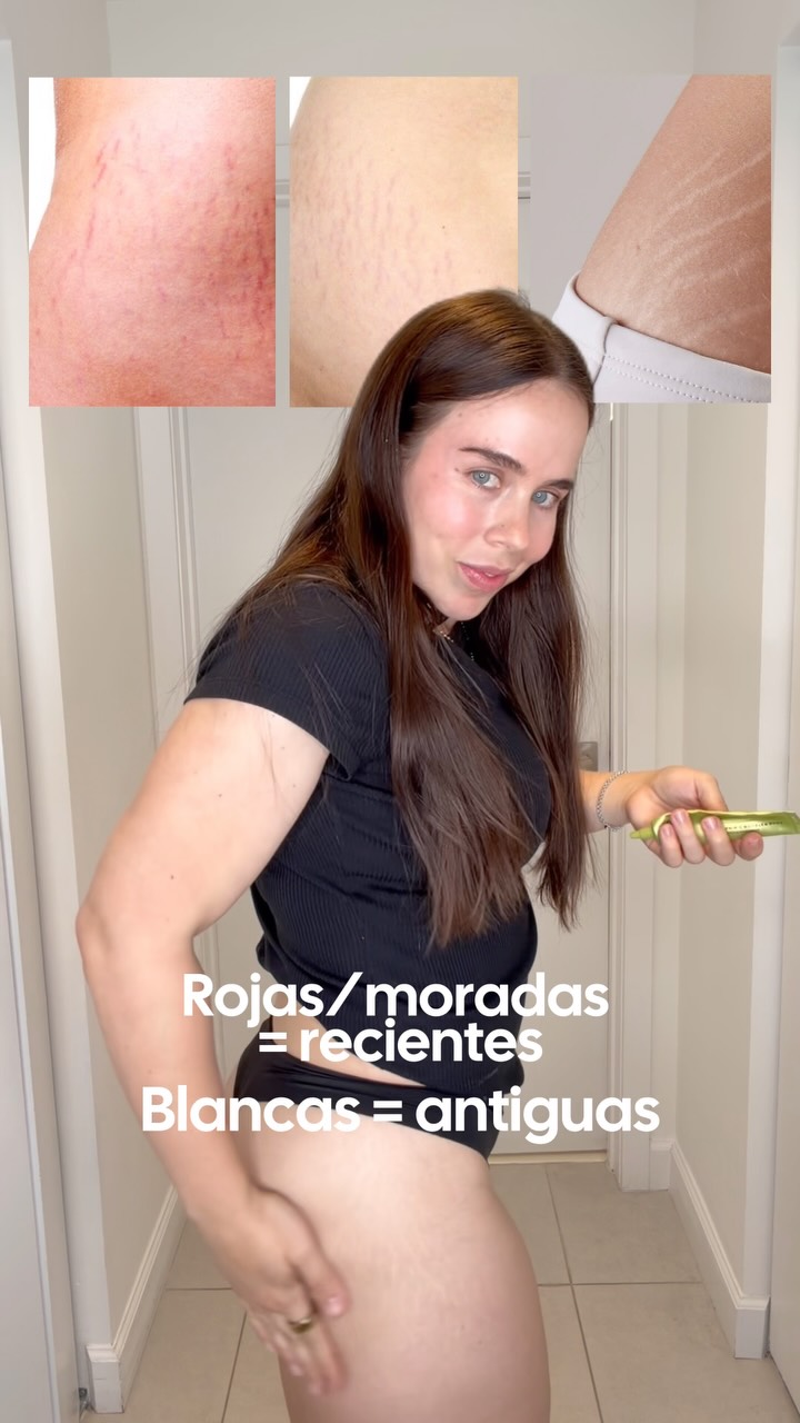 Arencia Global Facebook ad: Mi cuerpo cambió muchísimo después del embarazo, y…