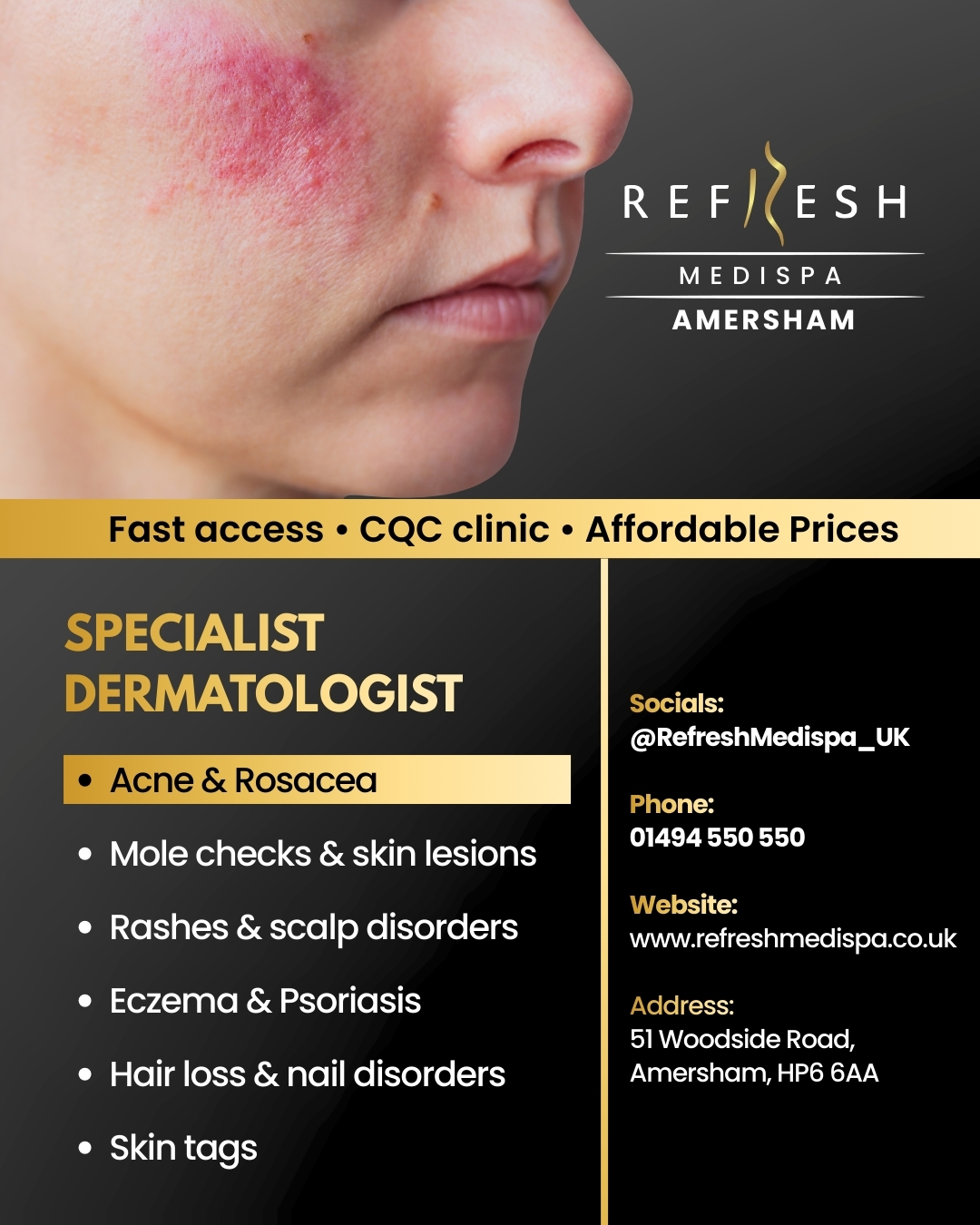 Refresh Medispa Amersham Facebook ad: See our Dermatology Specialist Fast