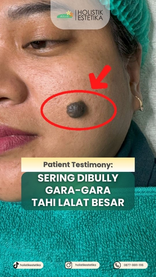 Holistik Estetika Facebook ad: BYE BYE BULLIES TAHI KAMBING TEH YUYUN SEKARANG…