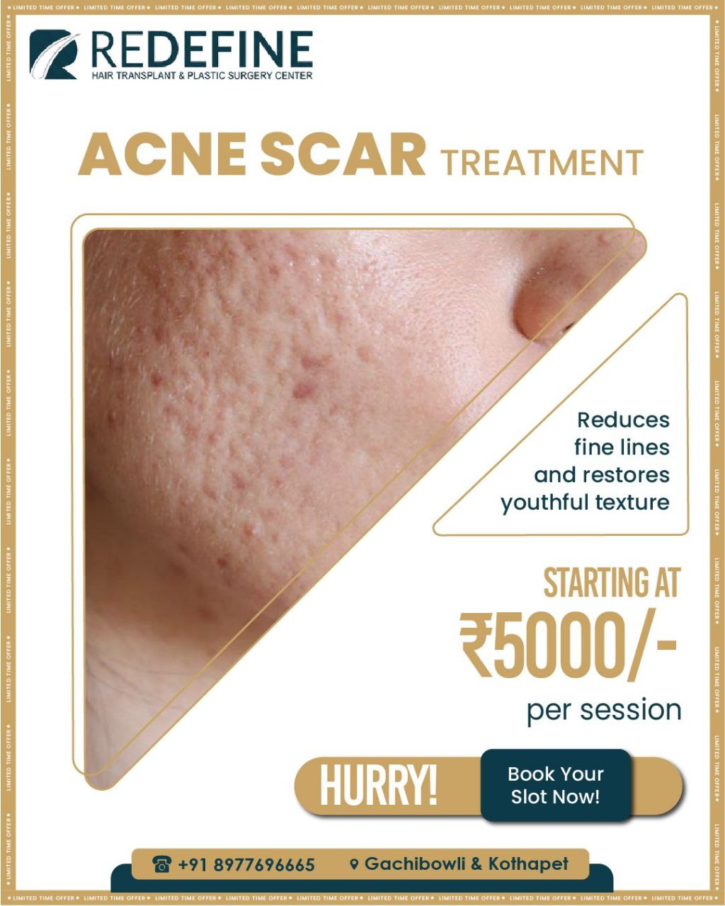 Redefine Skin and Hair Transplant Center Facebook ad