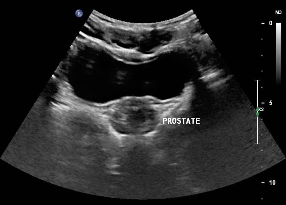 Urologist - Dr. Sarah Mitchell Facebook ad: Read This Before Taking a Prostate Prescription