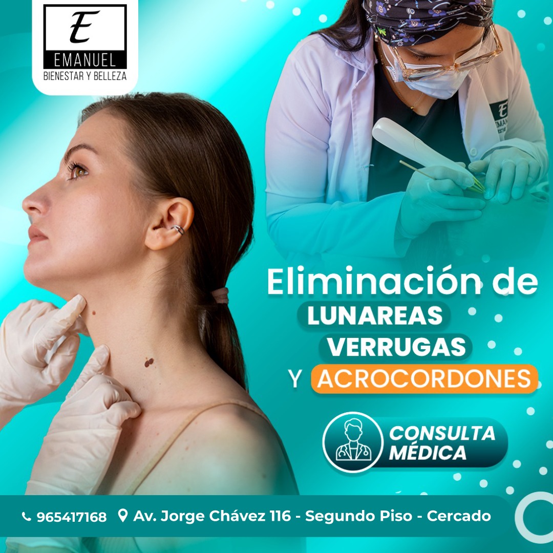 Emanuel Bienestar y Belleza Arequipa Facebook ad: ¡Despídete de lunares, verrugas y acrocordones de manera…