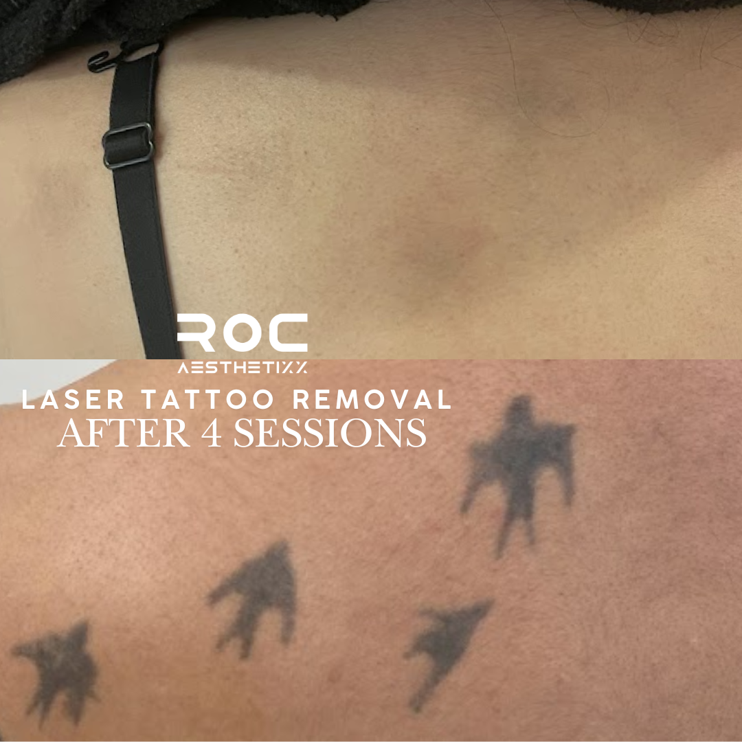Roc Aesthetics Facebook ad