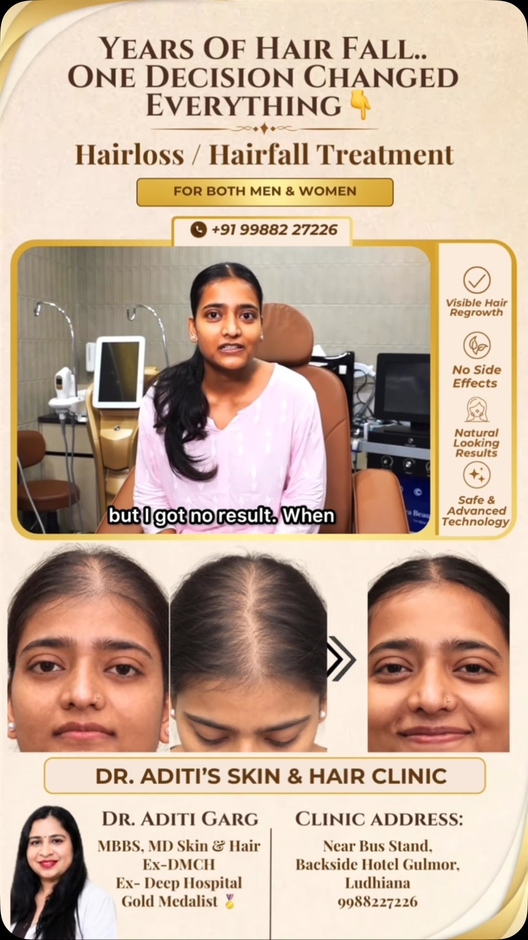 dr.aditiskinhair Facebook ad: I Was Scared Someone Would Notice My Scalp……