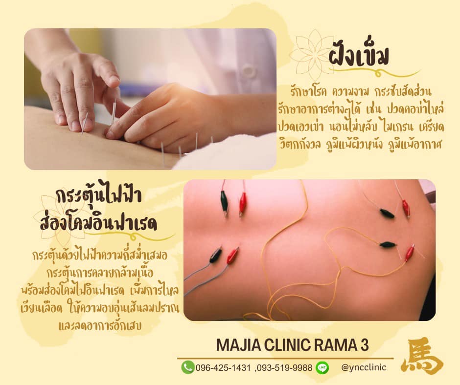 ฝังเข็ม ครอบแก้ว ยาจีน มาเจียคลินิก Majia Clinic พระราม3 ถนนจันทน์ สาทร Facebook ad: ฝังเข็ม ครอบแก้ว