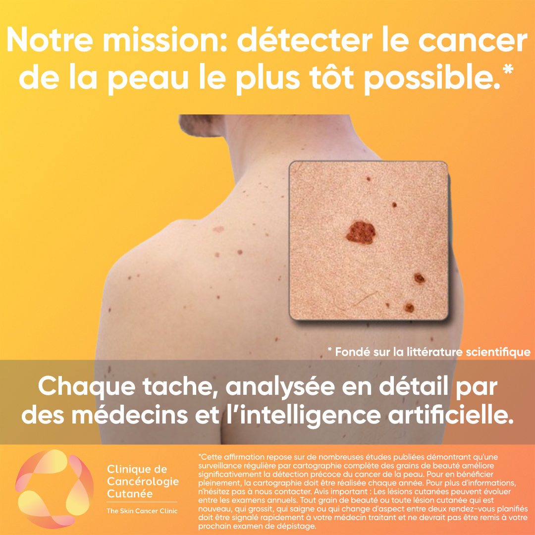 Clinique de Cancérologie Cutanée - The Skin Cancer Clinic of Montreal Facebook ad: Clinique de Cancérologie Cutanée | Dépistage cancer de la…
