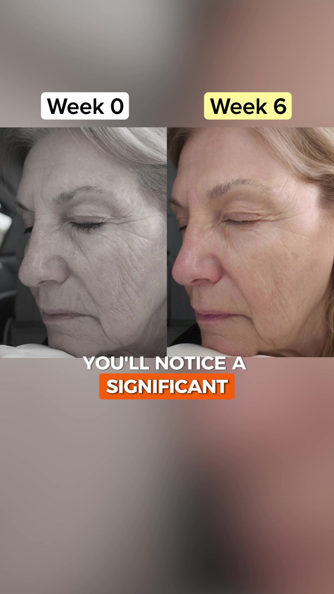 Based Supplies Facebook ad: Restore Your Skin in 3 Weeks!