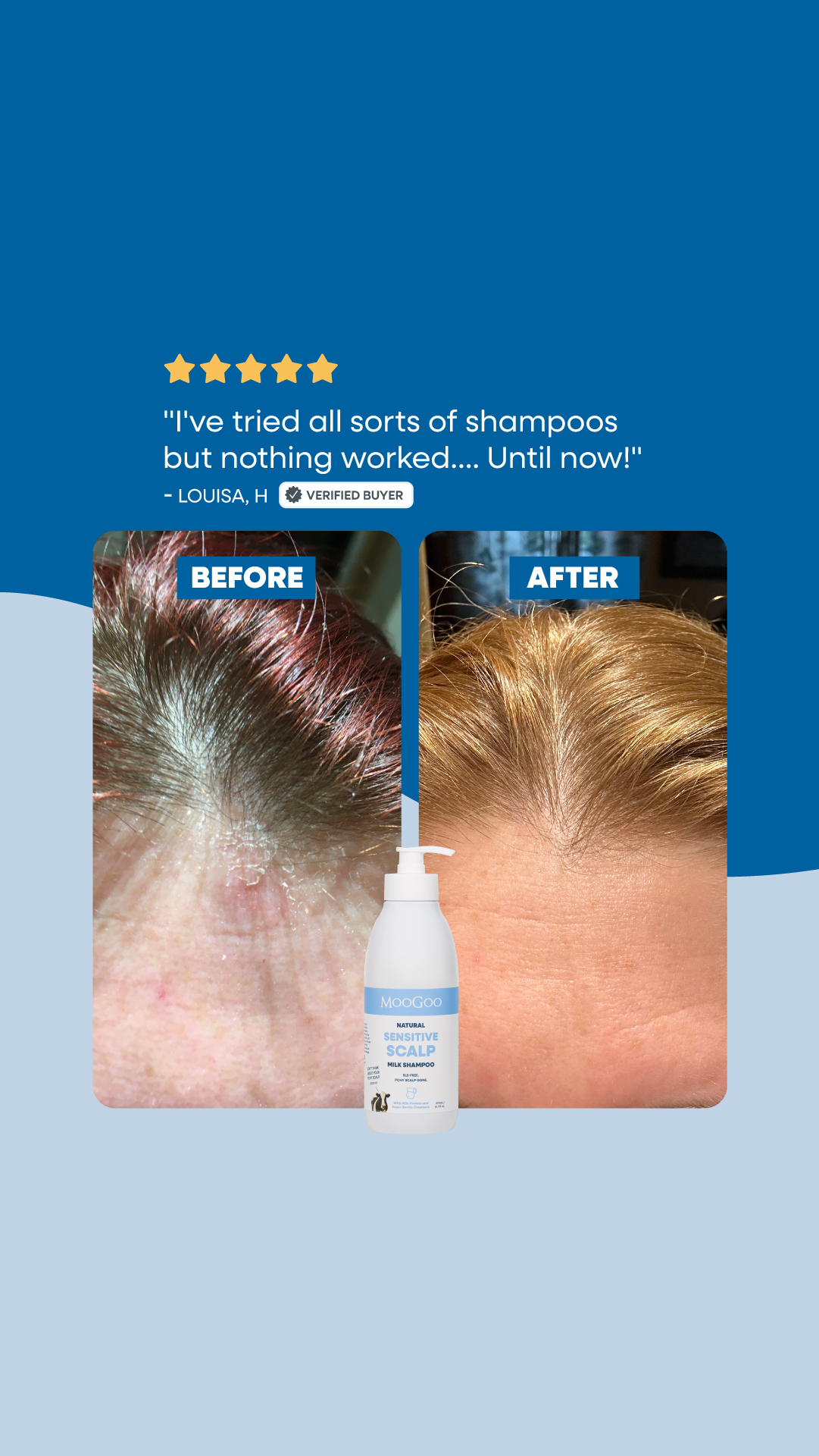 MooGoo Skin Care Facebook ad