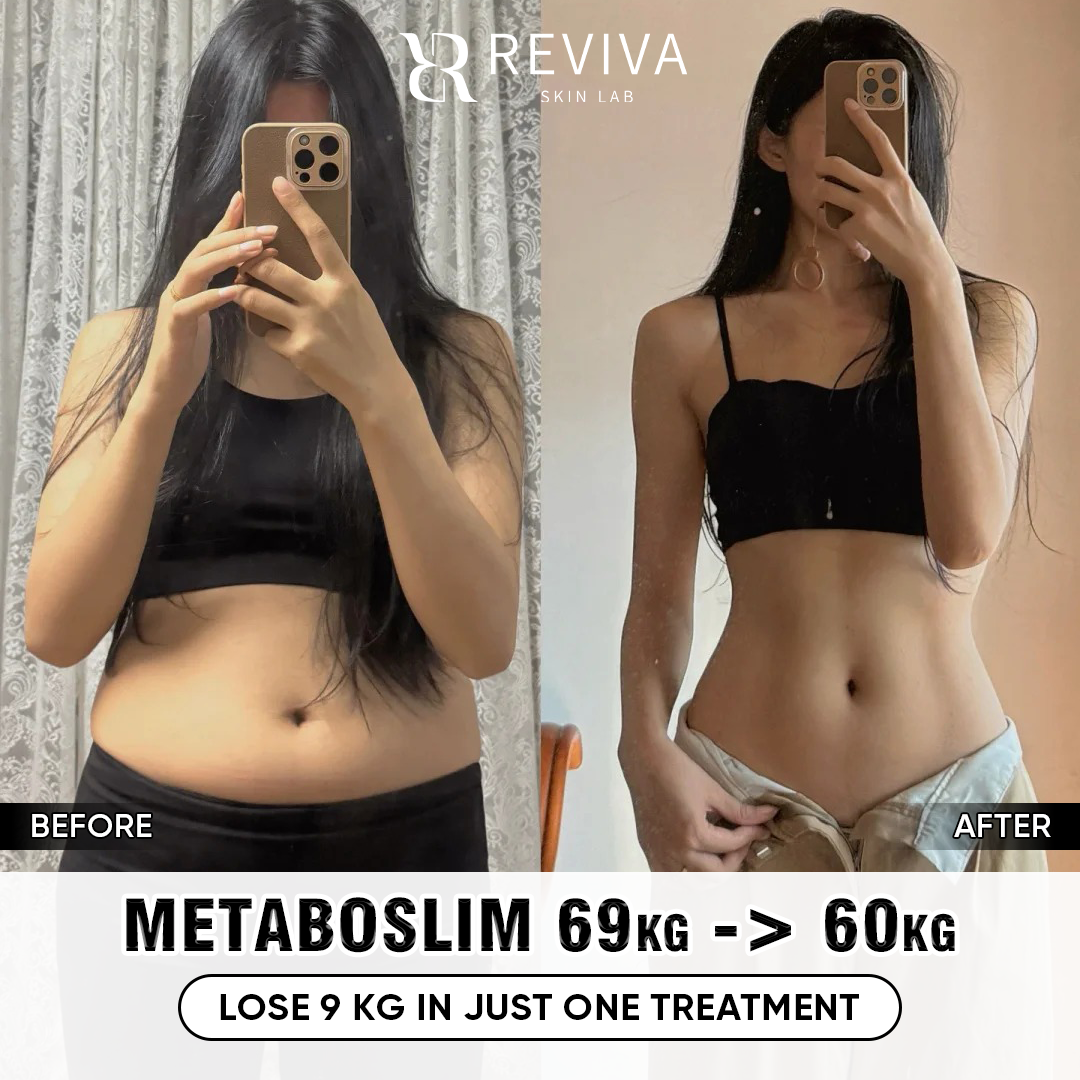 Reviva Aesthetic & Beauty Clinic - Iloilo Branch Facebook ad: Discount 35% First 10 Customers Only