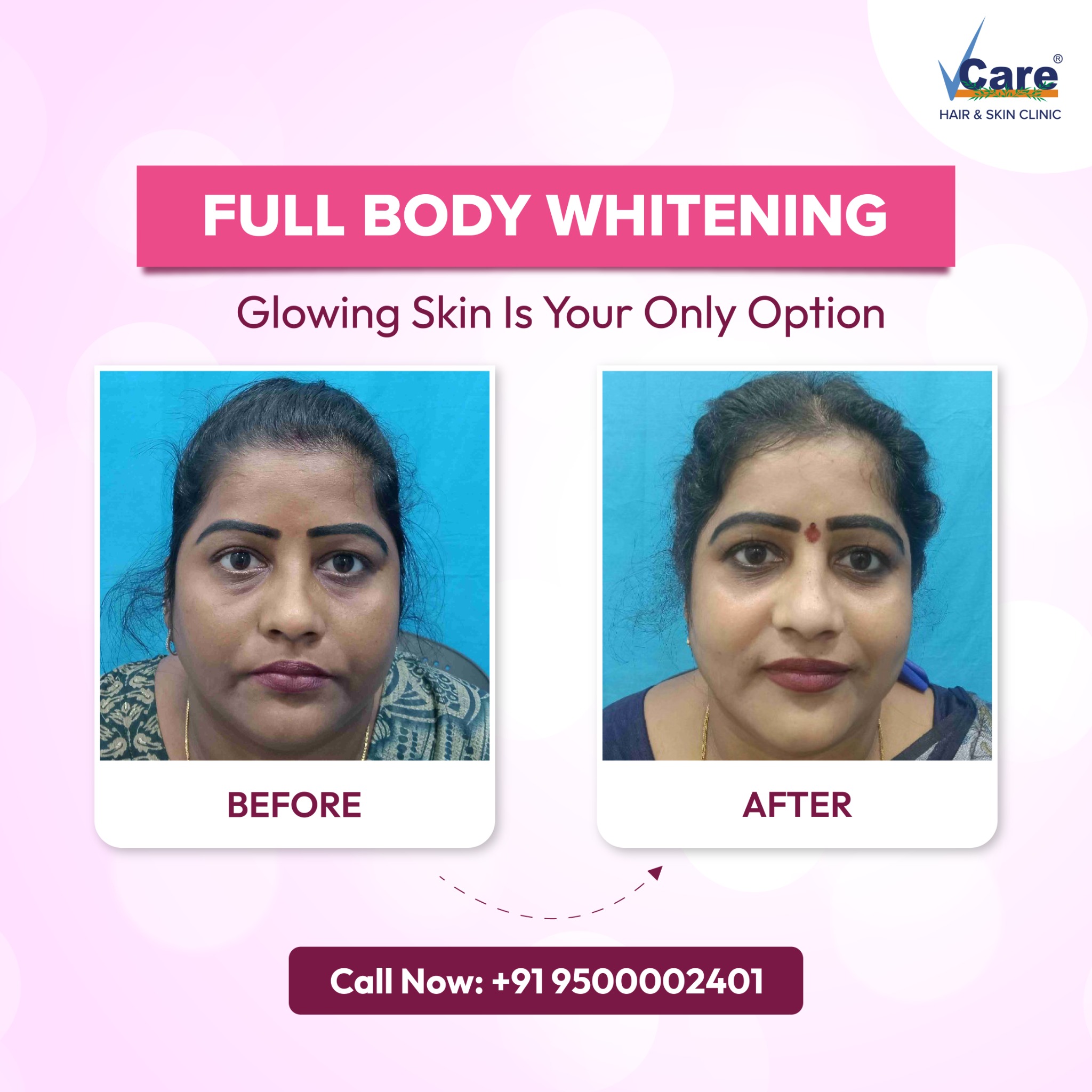 VCare West Facebook ad
