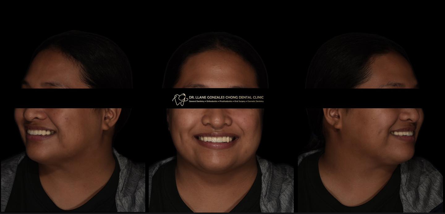 Dr. Llane Dental Clinic - MNL Facebook ad