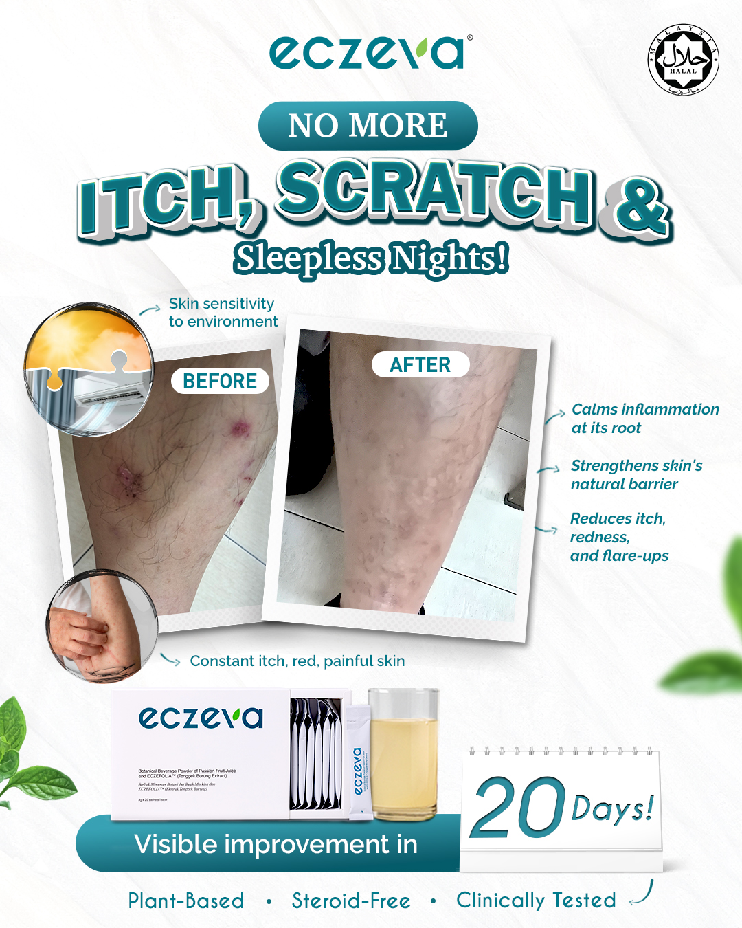 Eczeva Facebook ad: Your Solution for Eczema Healing