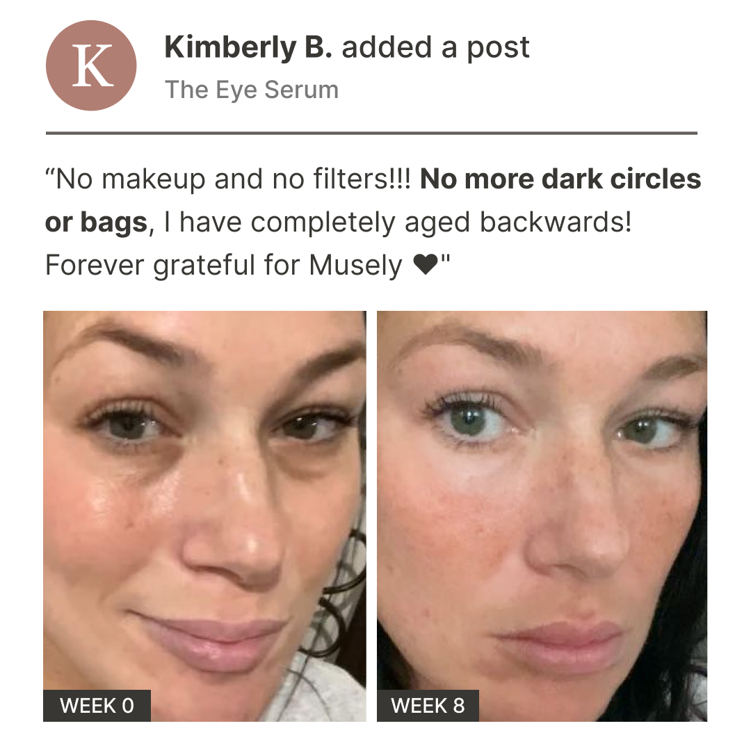 Musely Facebook ad