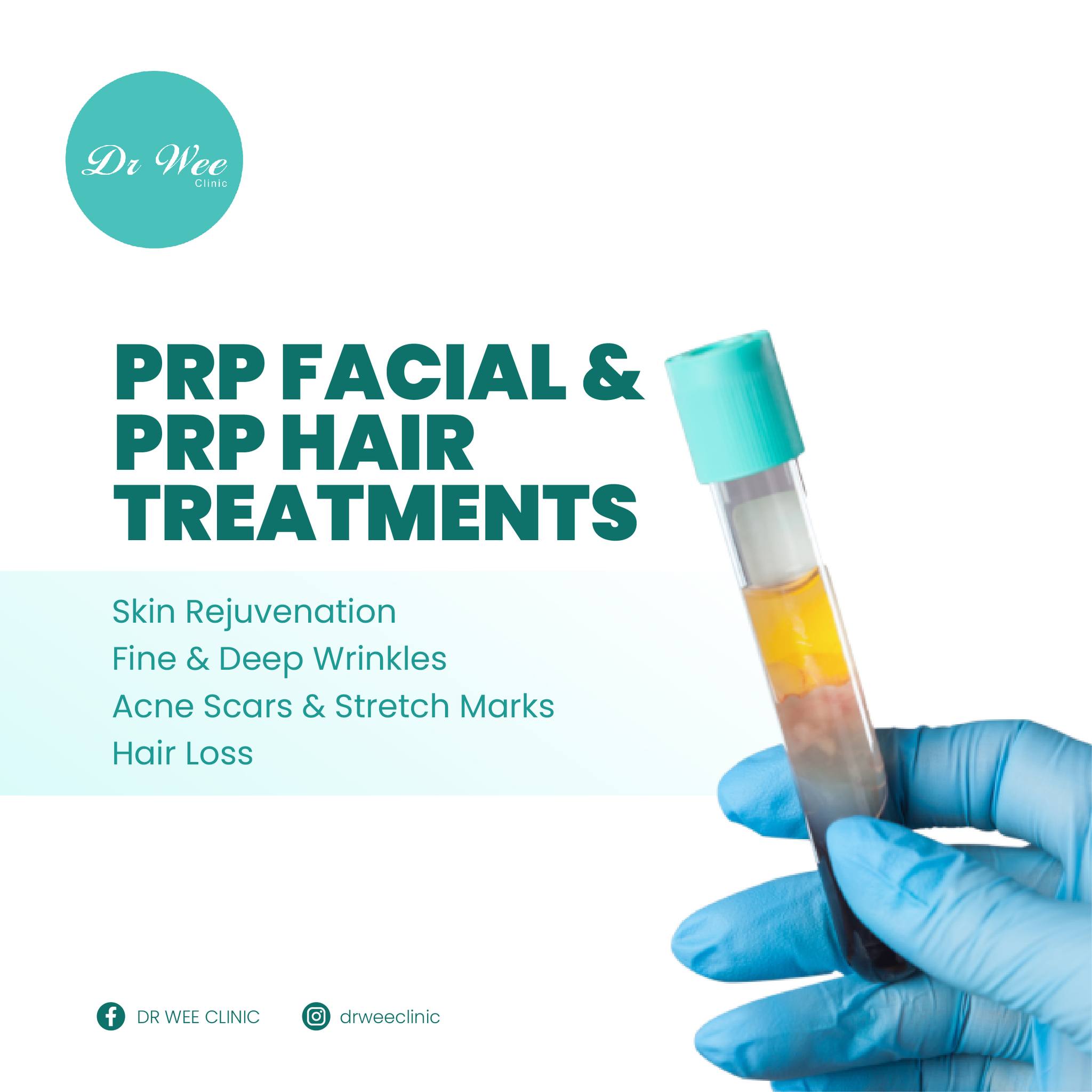 DR WEE Clinic Facebook ad: What is a PRP injection?