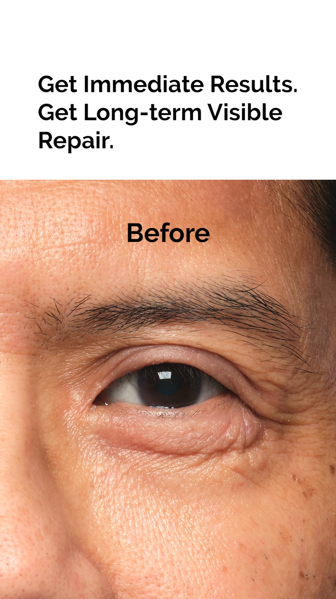 The Ordinary Facebook ad: Reimagine What An Eye Cream Can Do.