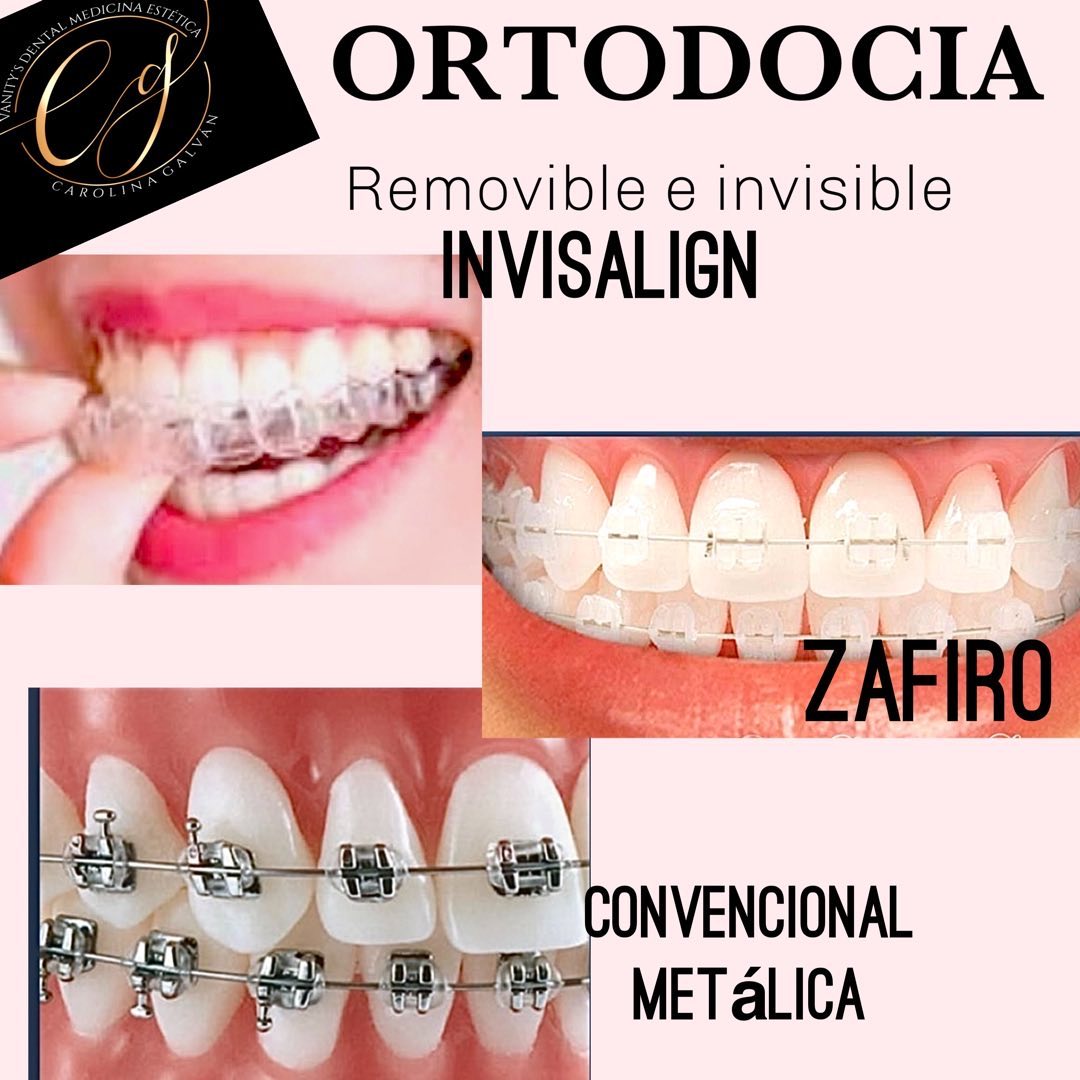 Odontóloga Carolina Galván Facebook ad: ORTODONCIA INVISIBLE/ ZAFIRO /CONVENCIONAL METÁLICA.