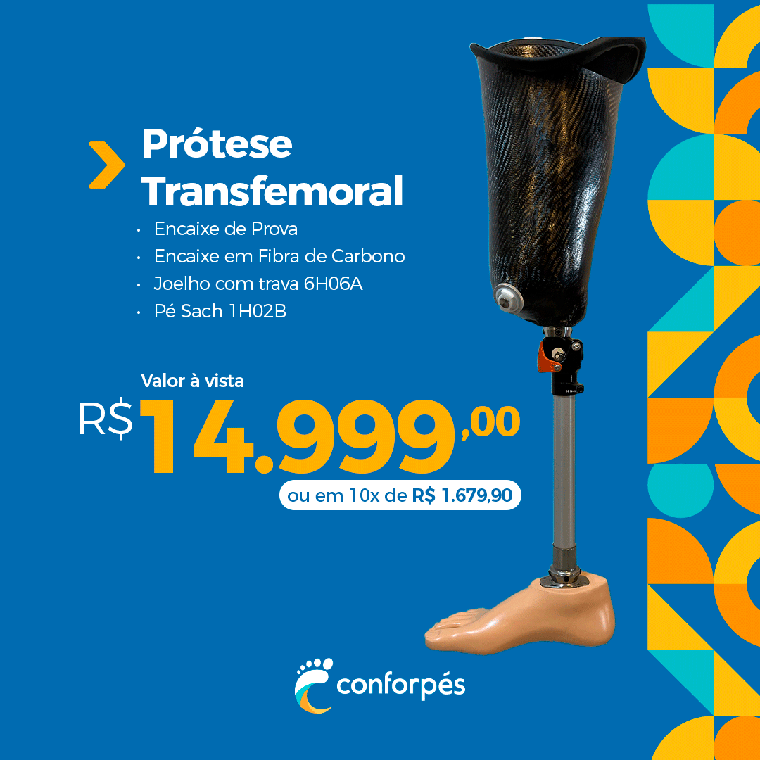 Ortopedia Conforpés Prótese Órtese Facebook ad: Agendar Avaliação Gratuita