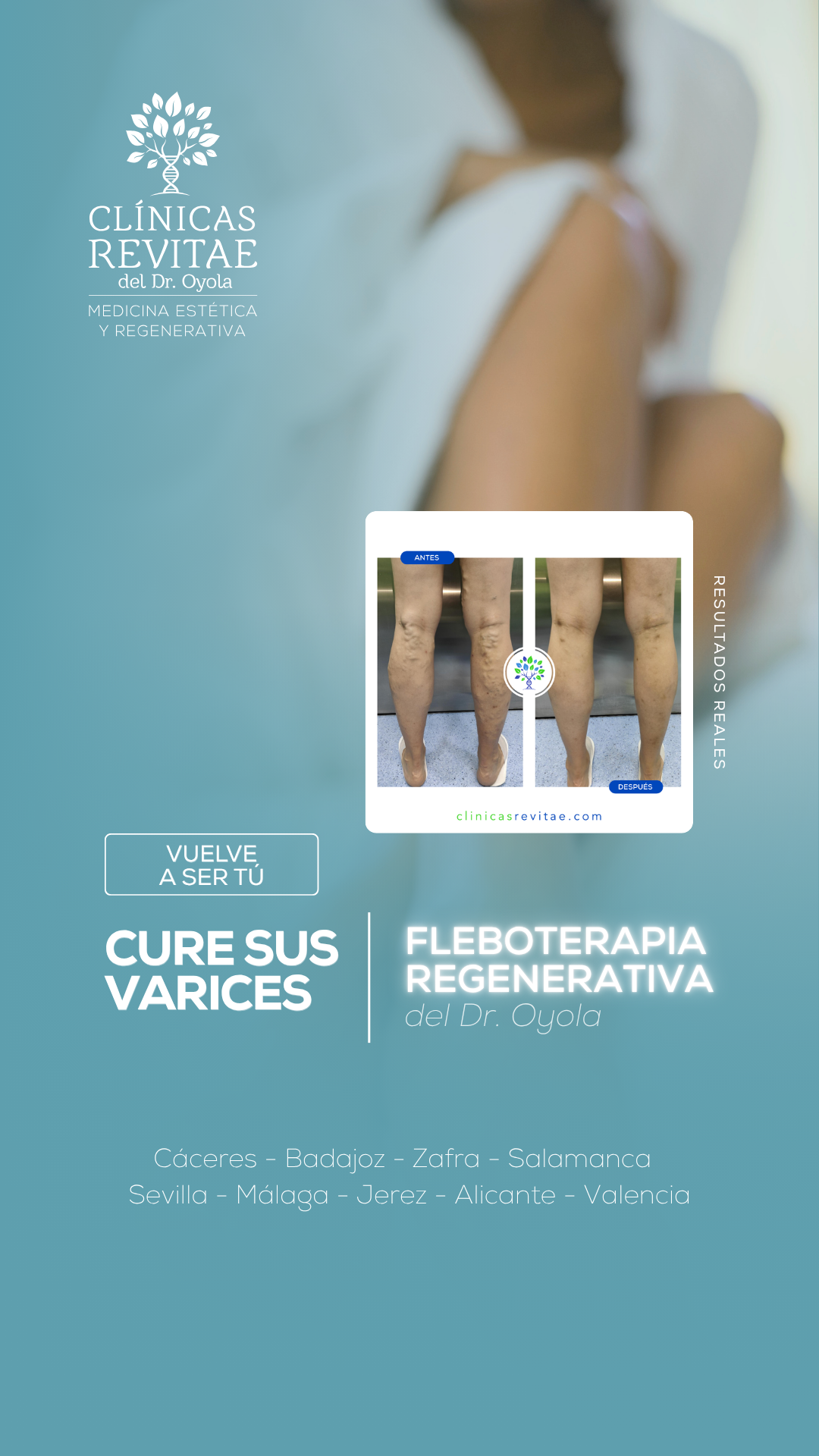 Clínicas Revitae Facebook ad