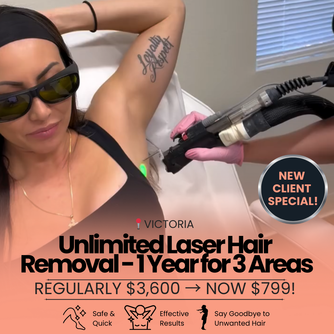 Victoria Laser and Beauty Facebook ad: Unlimited Laser Hair Removal 1 Year for 3 Areas NOW $799!