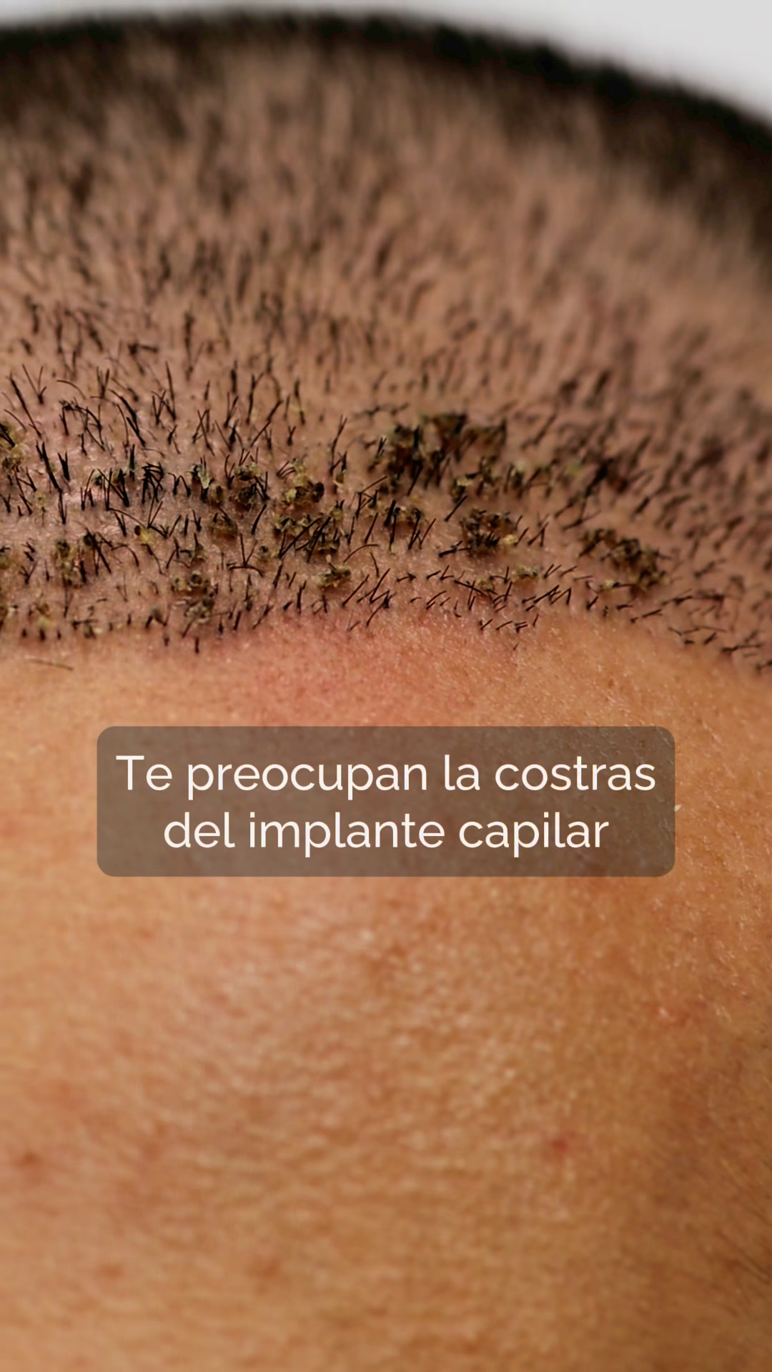 Drs.Pulido Facebook ad: Agenda una cita Gratis