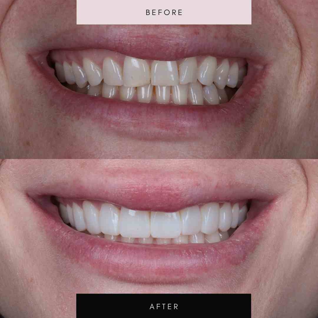 Dr Jin Thakrar Facebook ad: Your smile should be your greatest asset, not…