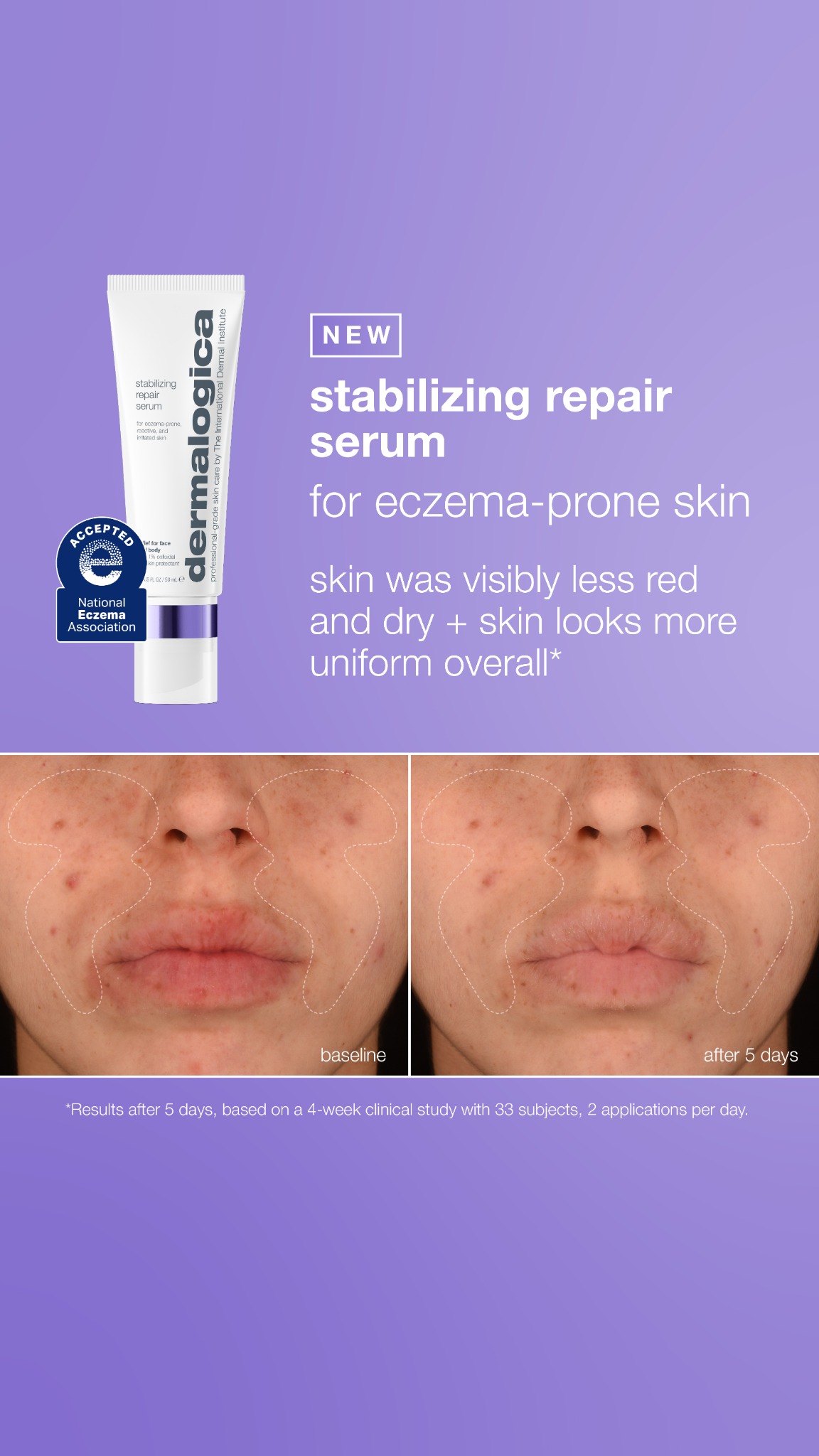 Dermalogica Facebook ad: Calm + Repair