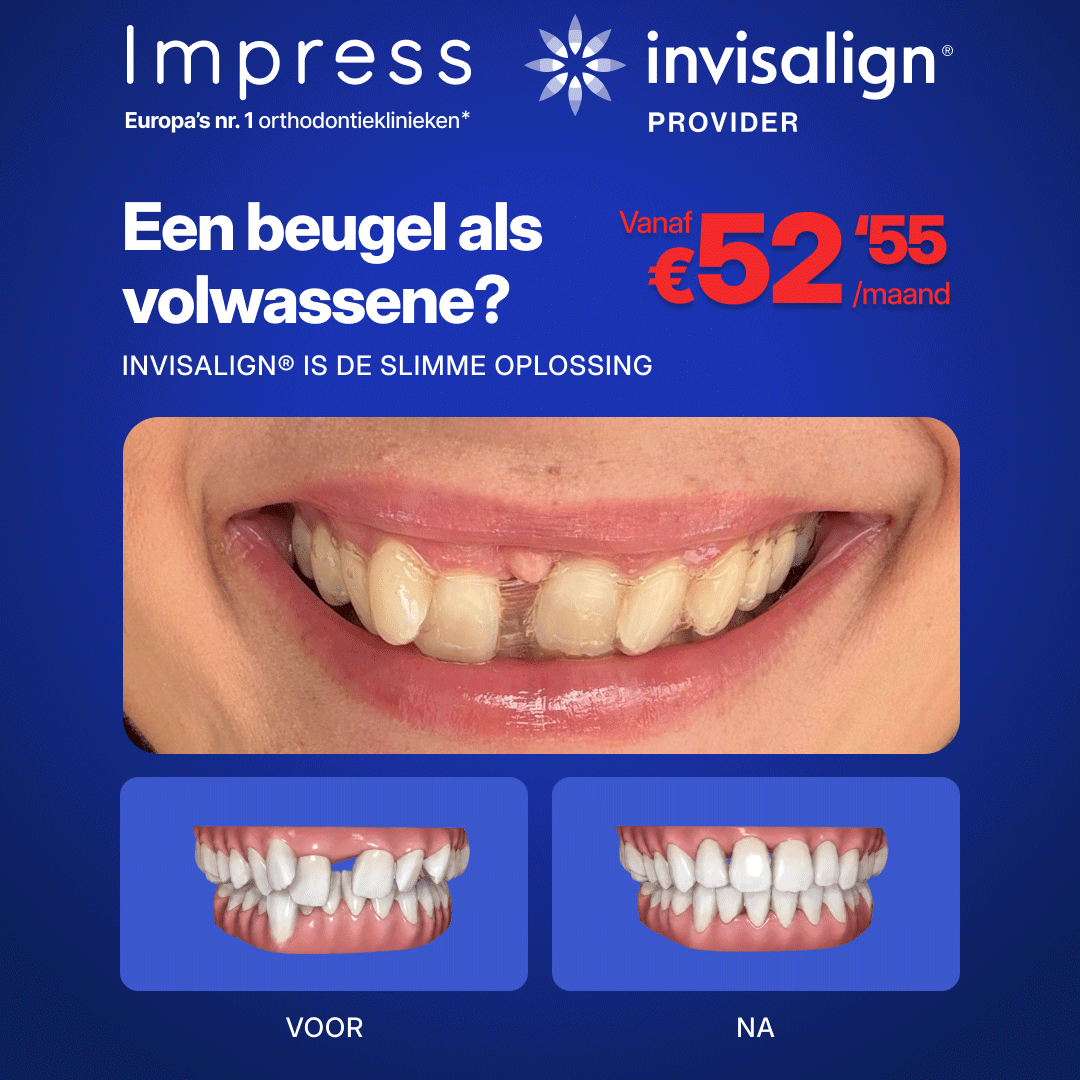 Impress Nederland Aligners Facebook ad