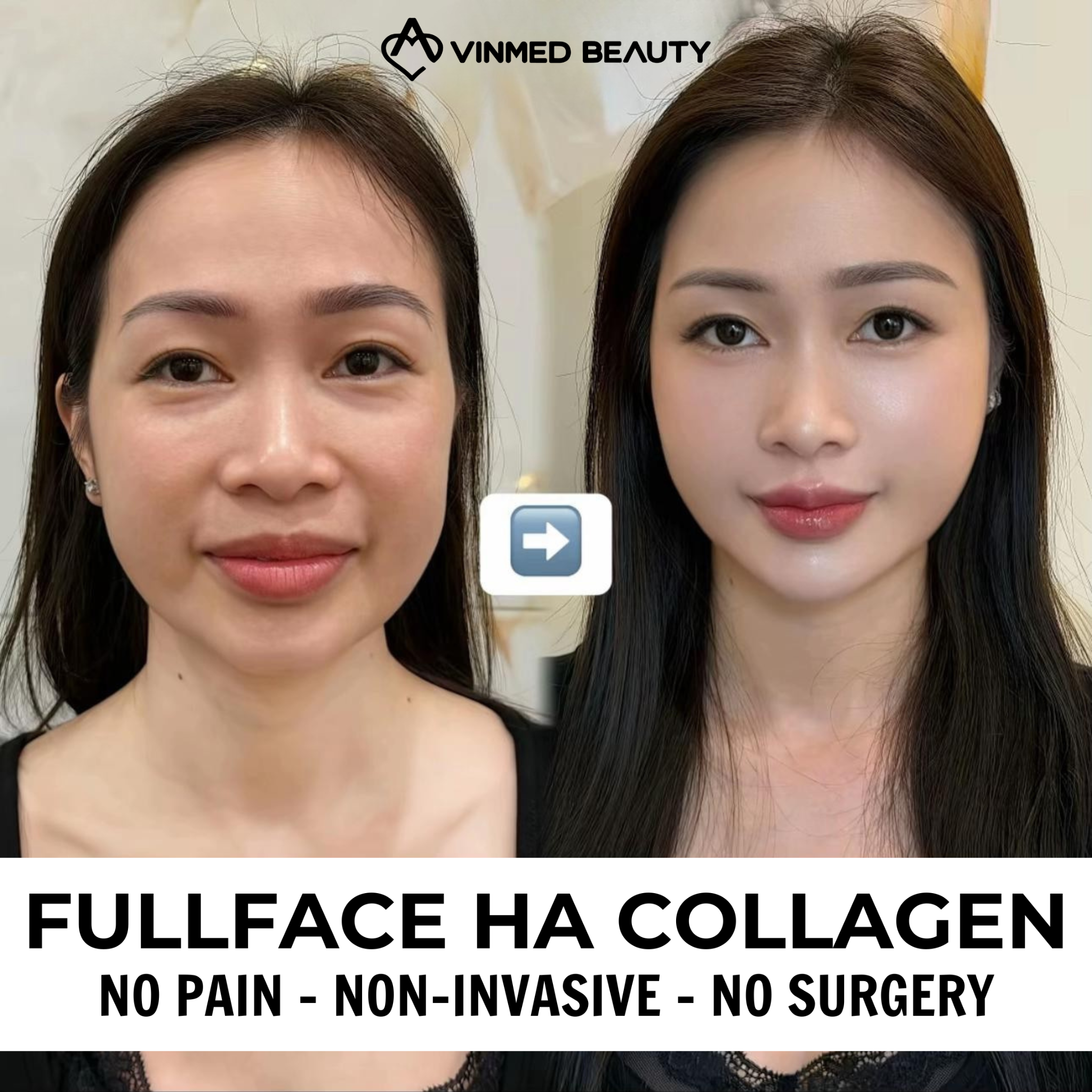 Vinmed Beauty - No. 1 Dermatology salon in Dubai Facebook ad