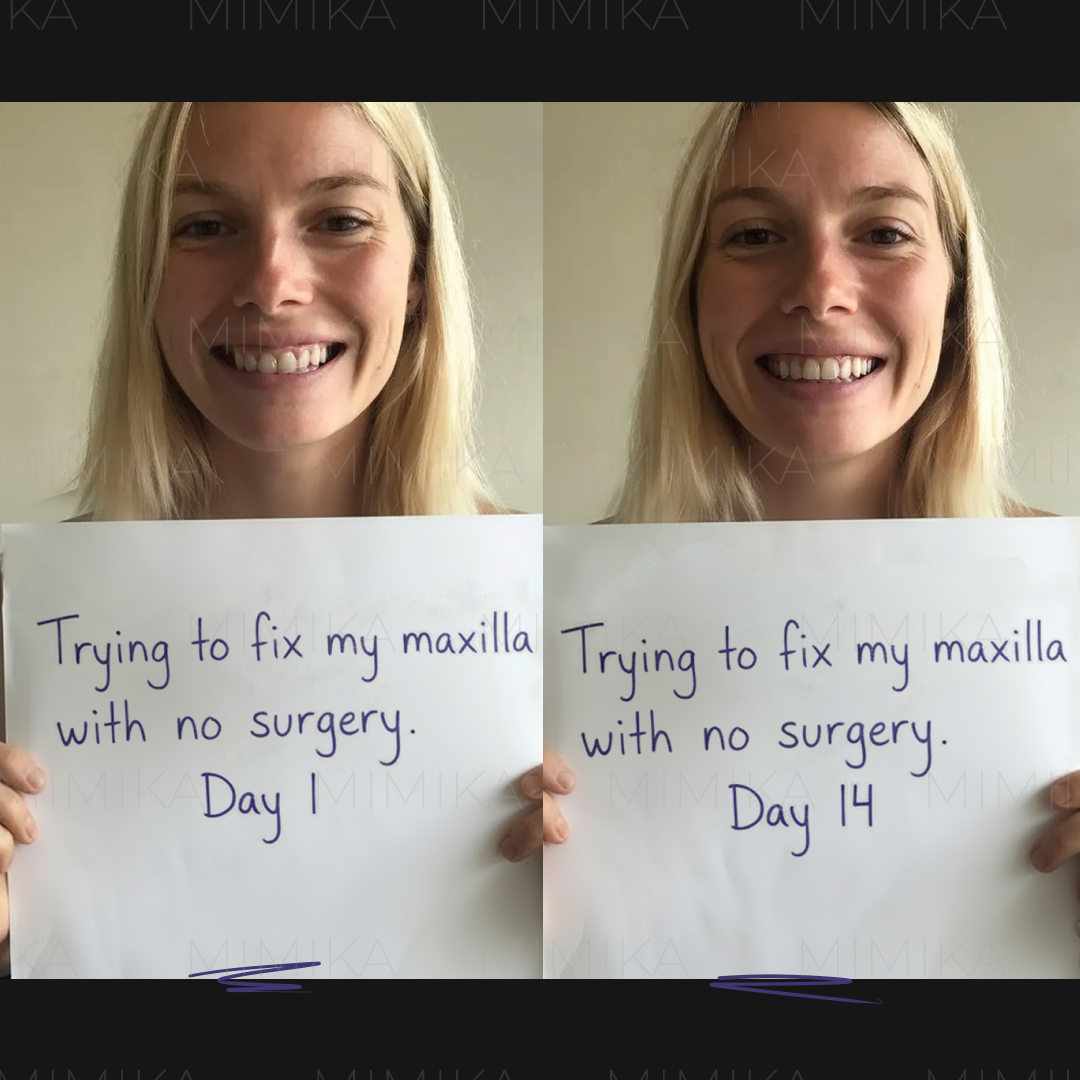 Mimika - Face Yoga Exercises Facebook ad