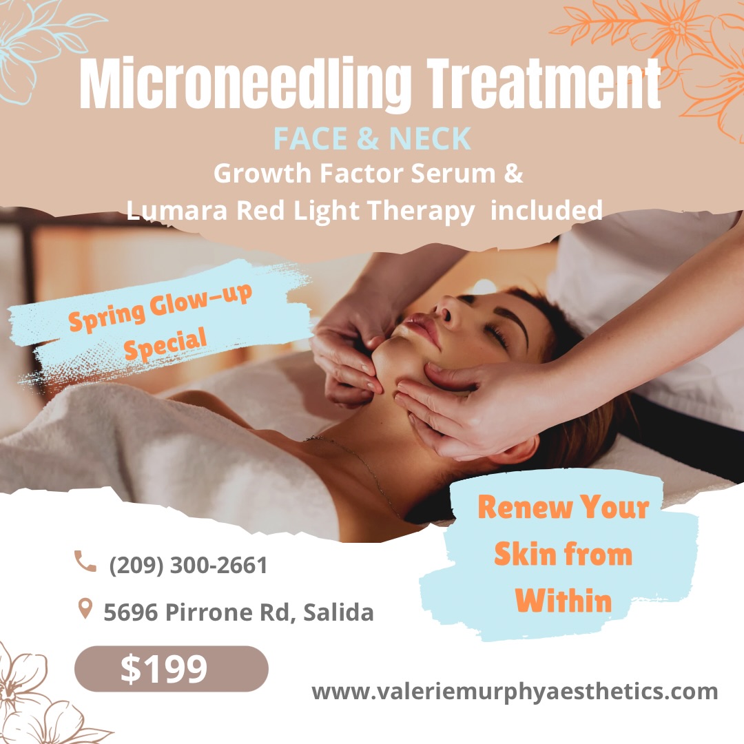 Valerie Murphy Aesthetics Facebook ad: READY FOR YOUR SPRING SKIN RESET?