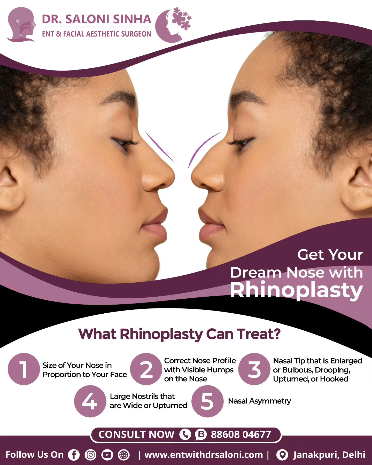 ENT & Cosmetic Clinic Facebook ad: What Rhinoplasty Can Treat?