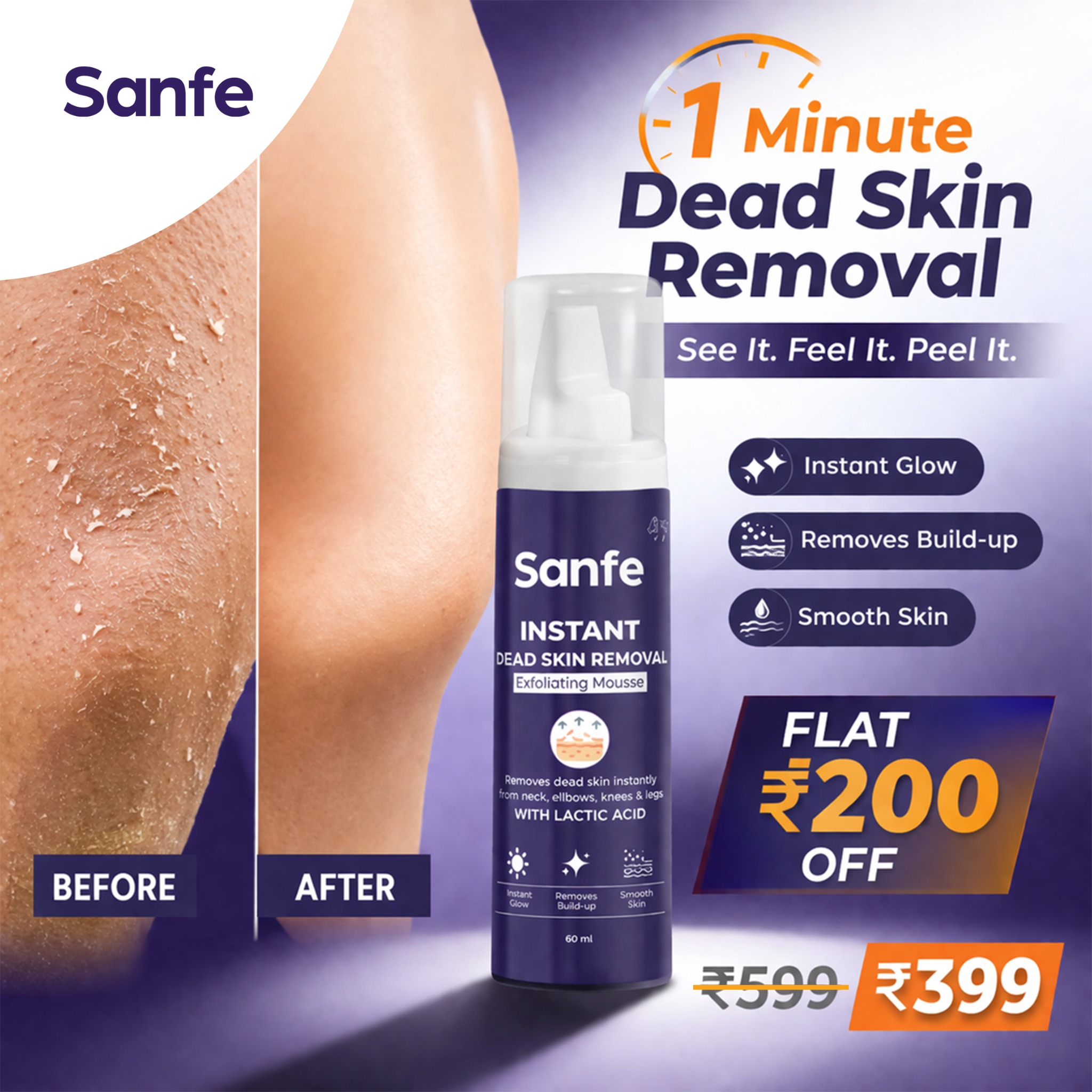 SanfeFanpage Facebook ad: Still dealing with dull, flaky skin?