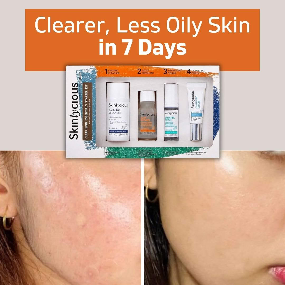 Skinlycious Facebook ad