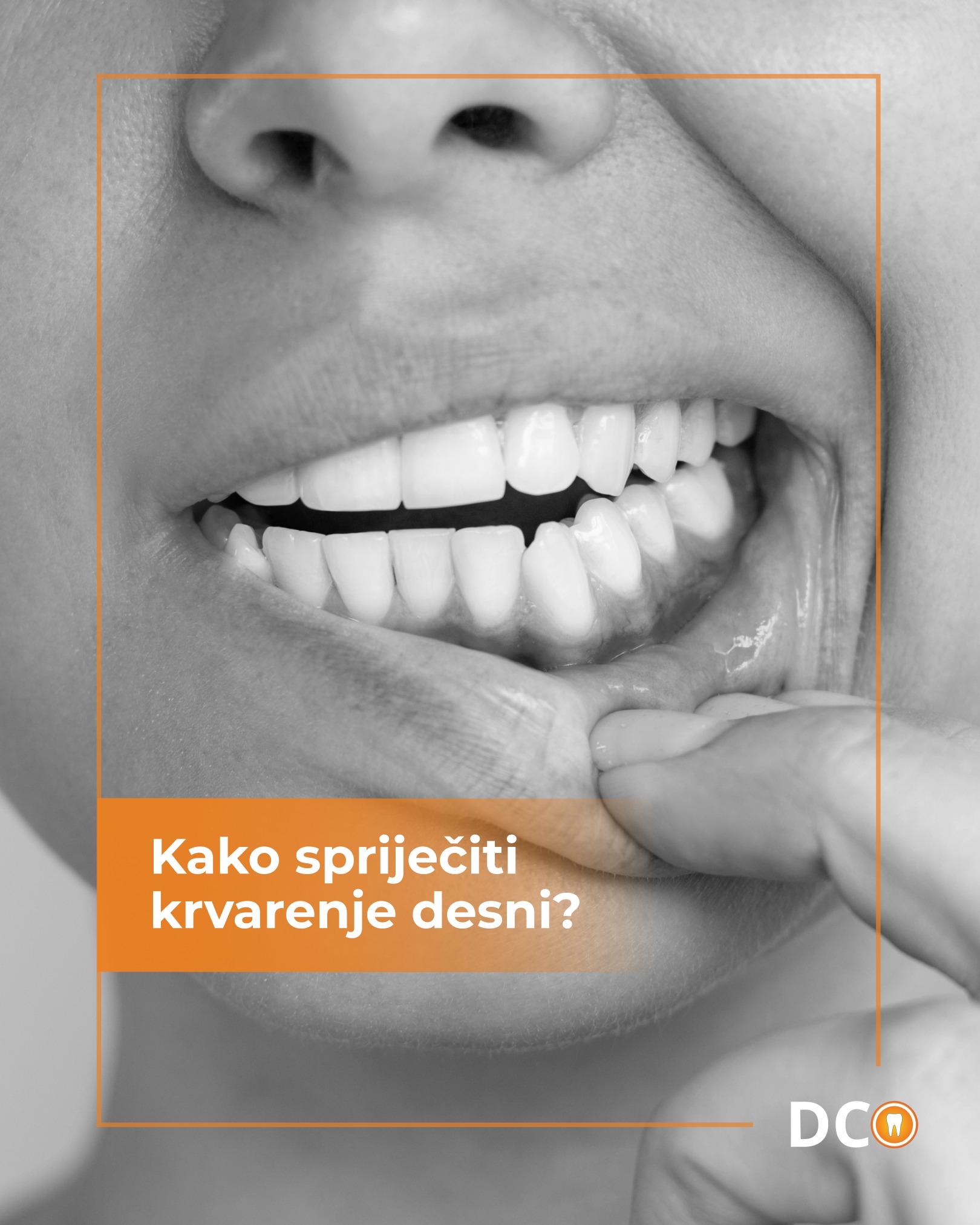 Dental Centar Ostojić Facebook ad