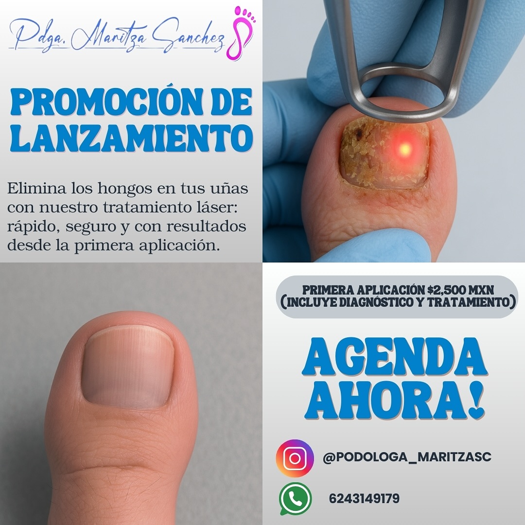 Podologa Maritza Sanchez Facebook ad: Uñas libres de hongos con tecnología láser