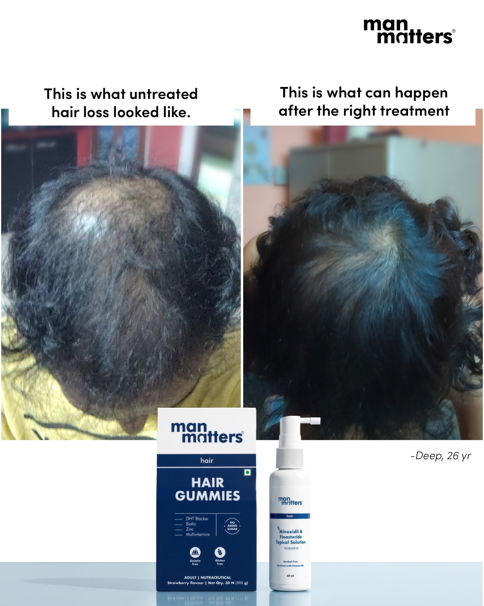 manmattershairwarriors Facebook ad