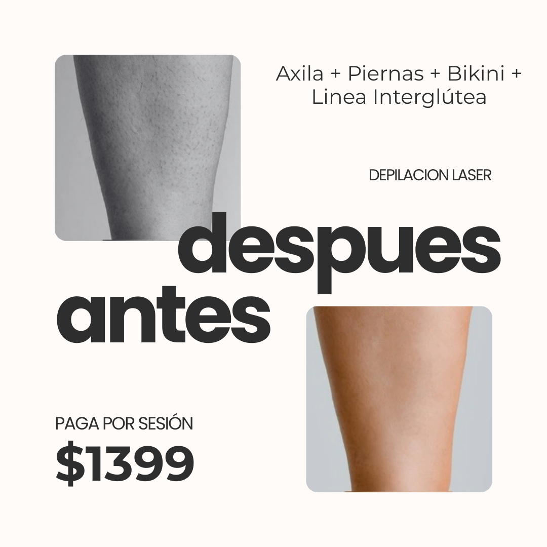 SKIN ZONE Punto Escobedo Facebook ad from Feb 26, 2026