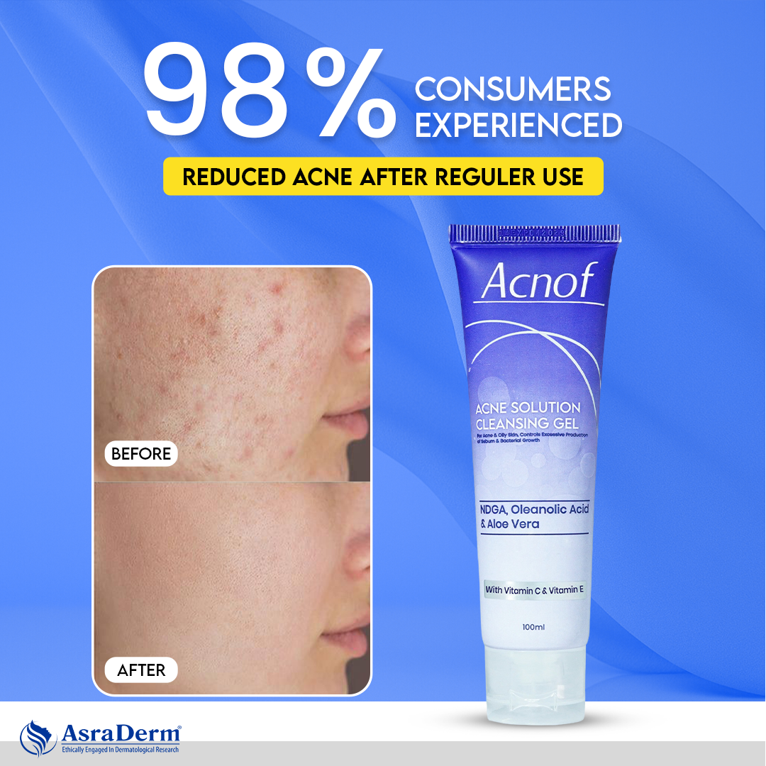 Asra Derm Official Facebook ad