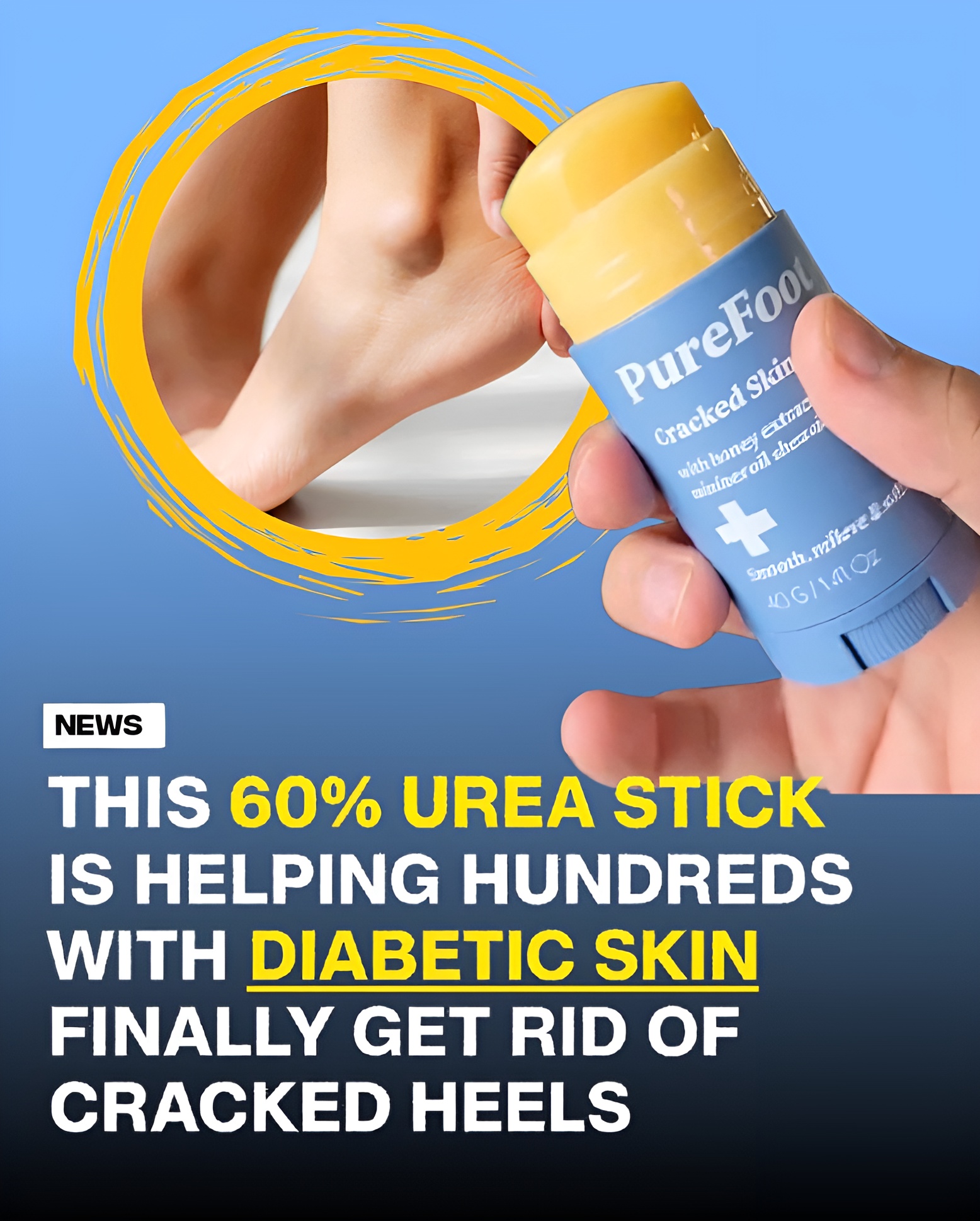 Foot Insiders Facebook ad: The World’s First 60% Urea Footcare