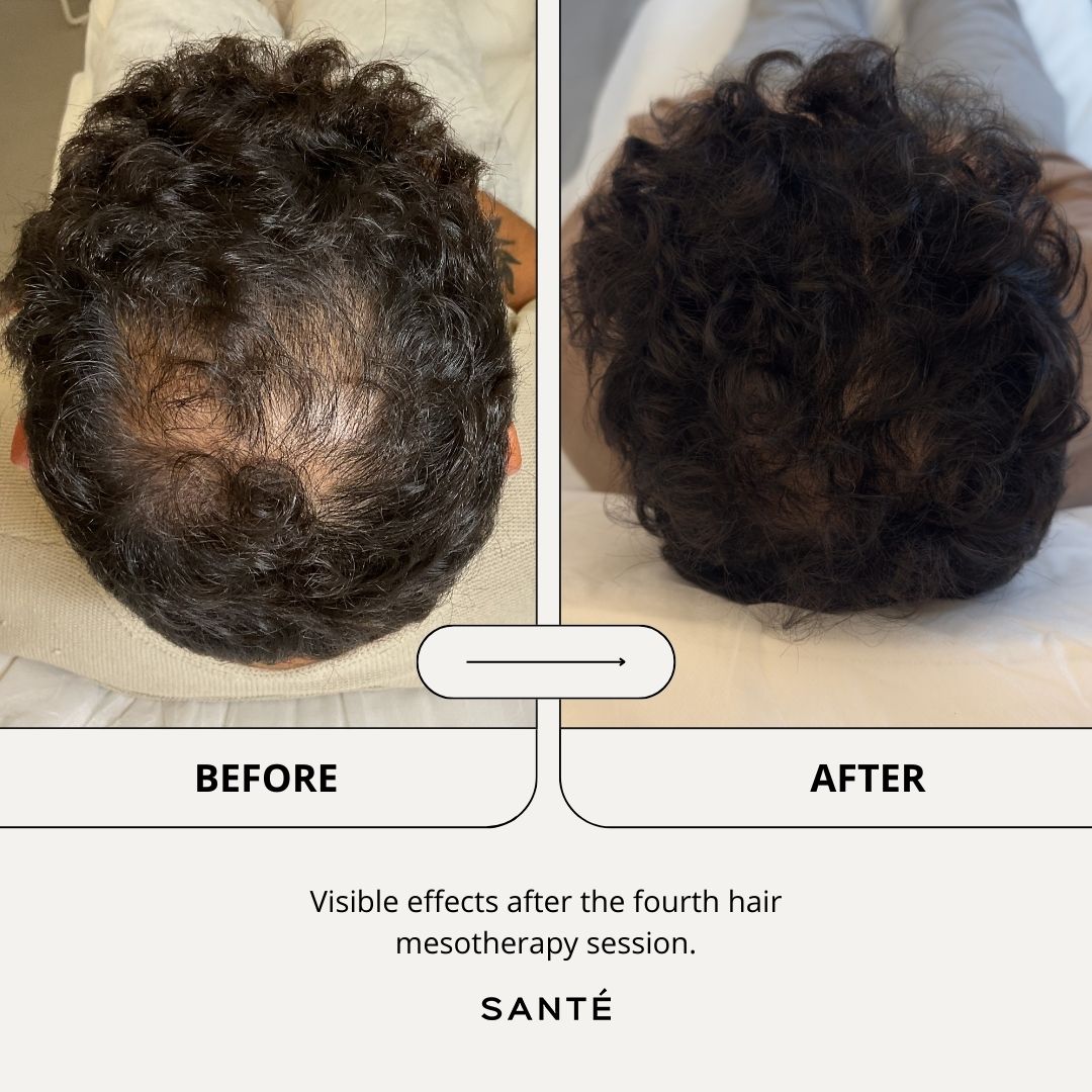 SANTÉ Clínica Estética Facebook ad