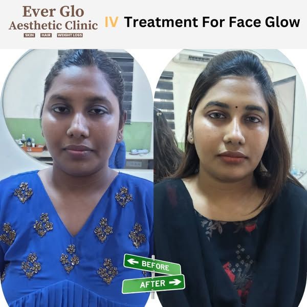 Everglo Aesthetic Clinic Facebook ad