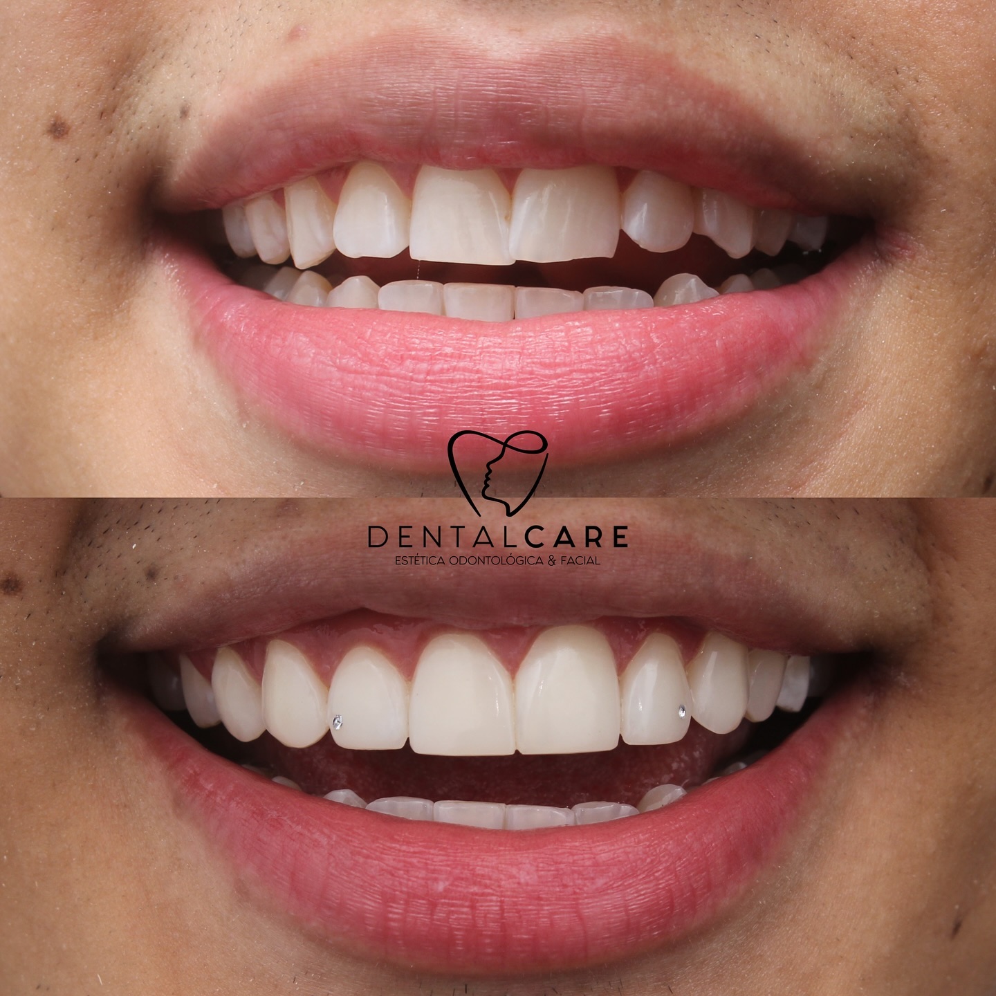 Dental Care Odontologia Facebook ad