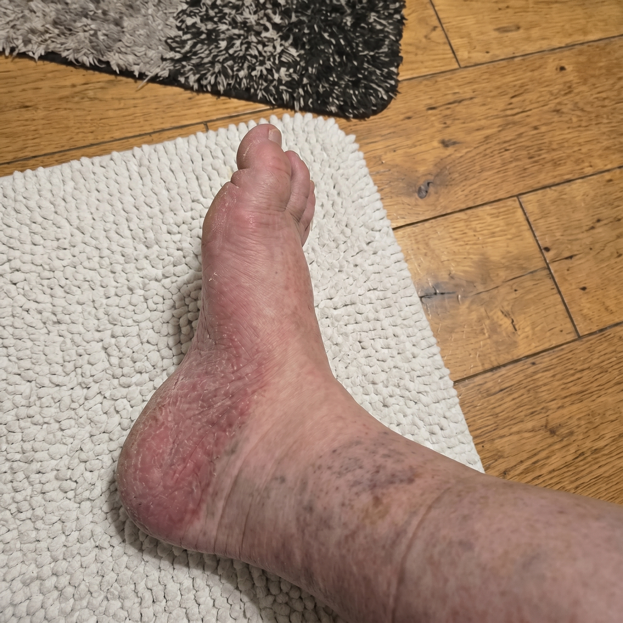 Parkinson Recovery Community Facebook ad